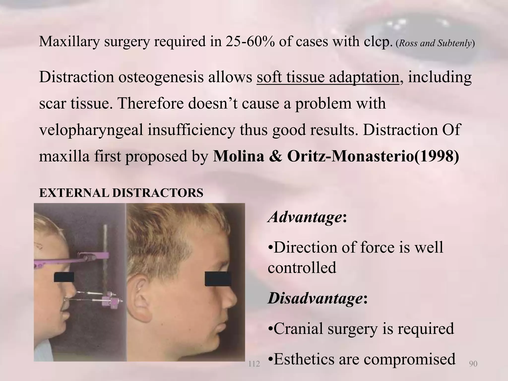 Maxillary surgery required in 25-60% of cases with clcp. (Ross and Subtenly)
Distraction osteogenesis allows soft tissue adaptation, including
scar tissue. Therefore doesn’t cause a problem with
velopharyngeal insufficiency thus good results. Distraction Of
maxilla first proposed by Molina & Oritz-Monasterio(1998)
EXTERNAL DISTRACTORS
Advantage:
•Direction of force is well
controlled
Disadvantage:
•Cranial surgery is required
•Esthetics are compromised 90112
 