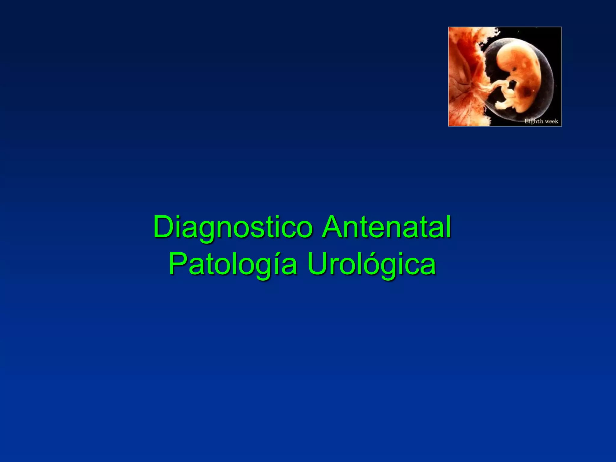 Diagnostico Antenatal
Patología Urológica
 