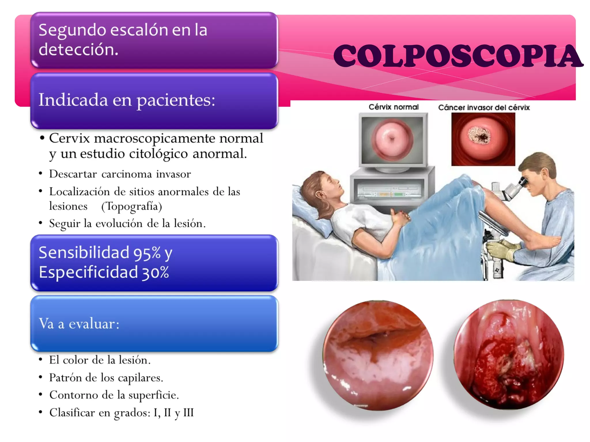 COLPOSCOPIA
 