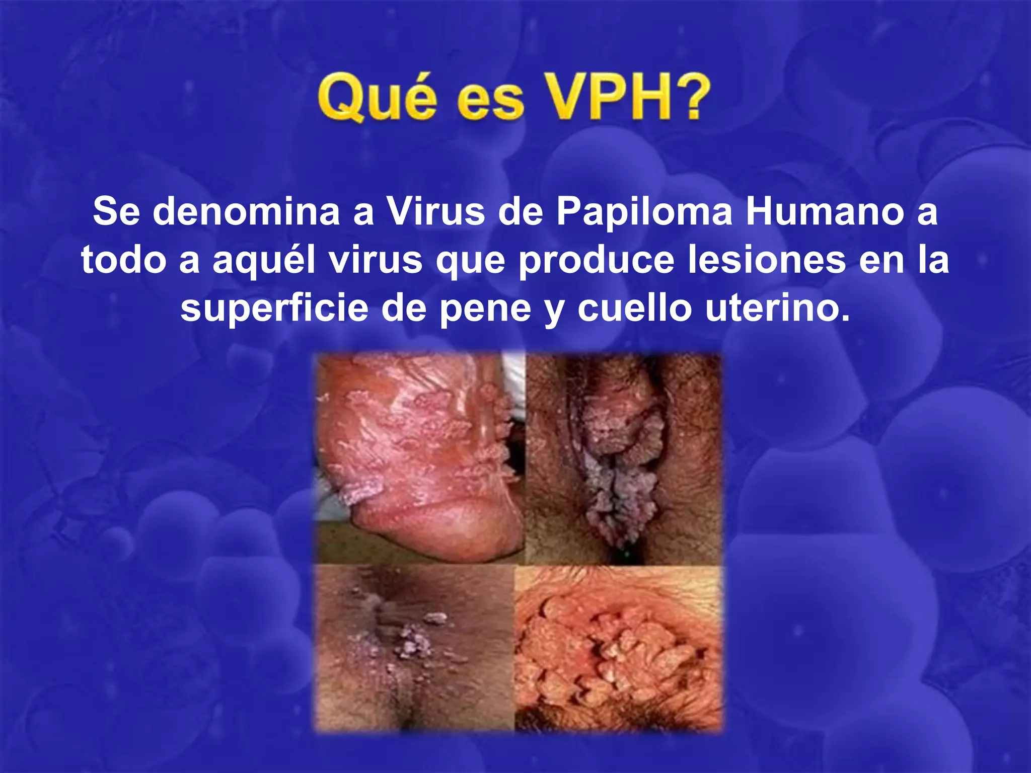 Se denomina a Virus de Papiloma Humano a
todo a aquél virus que produce lesiones en la
     superficie de pene y cuello uterino.
 