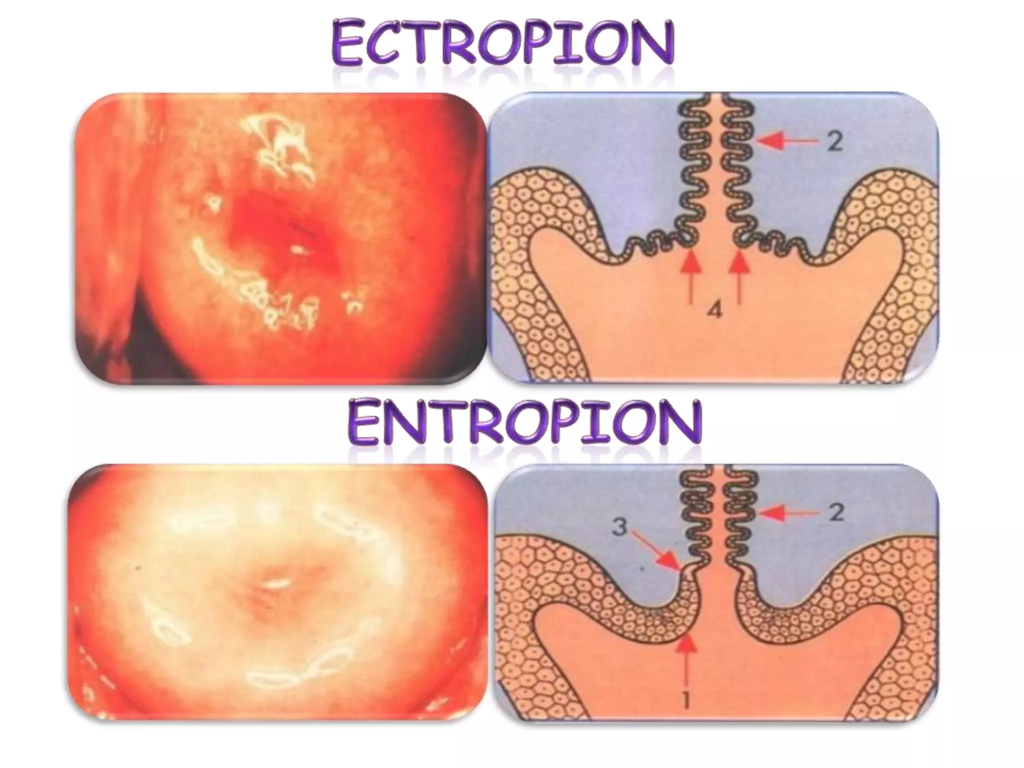 PATOGENICIDADVías de transmisión :Sexual Familiar por fomitesHospitalaria : por fomitesMaterno Neonatal : intrapartoPeripartoEl contagio se da atraves de pequeños fragmentos de tejidos infectado que  penetran a traves de microabrasiones  durante el coito  Órganos mas frecuentemente afectados : 