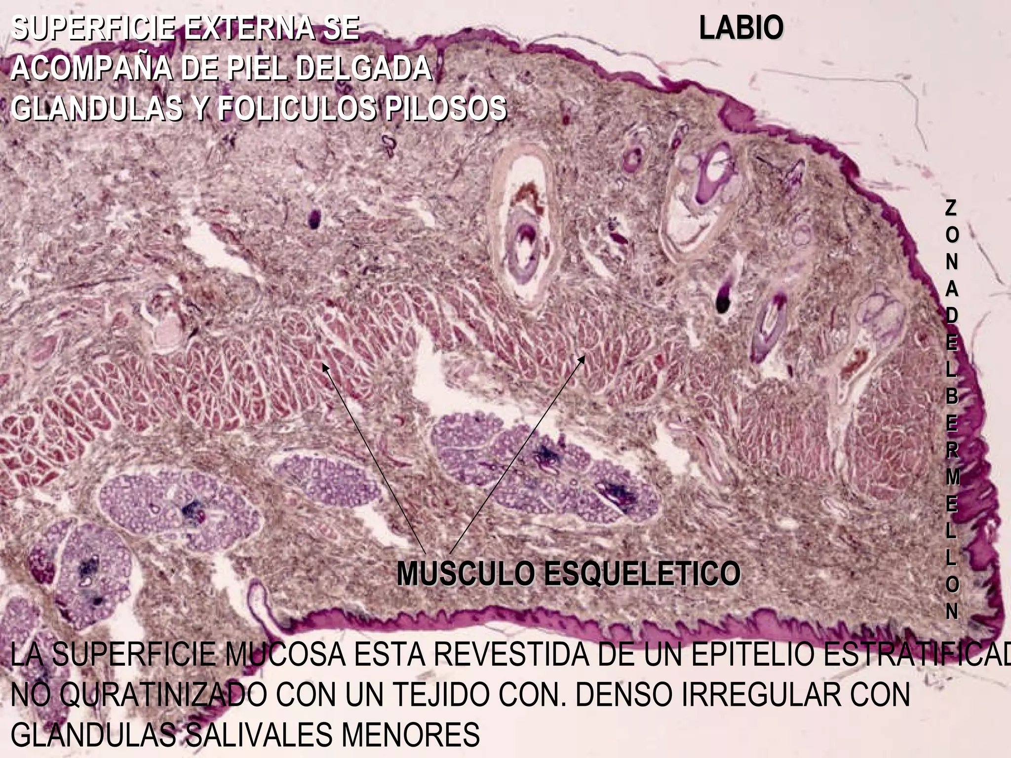LABIO MUSCULO ESQUELETICO SUPERFICIE EXTERNA SE ACOMPAÑA DE PIEL DELGADA GLANDULAS Y FOLICULOS PILOSOS ZONA DEL BERMELLON LA SUPERFICIE MUCOSA ESTA REVESTIDA DE UN EPITELIO ESTRATIFICADO NO QURATINIZADO CON UN TEJIDO CON. DENSO IRREGULAR CON GLANDULAS SALIVALES MENORES
