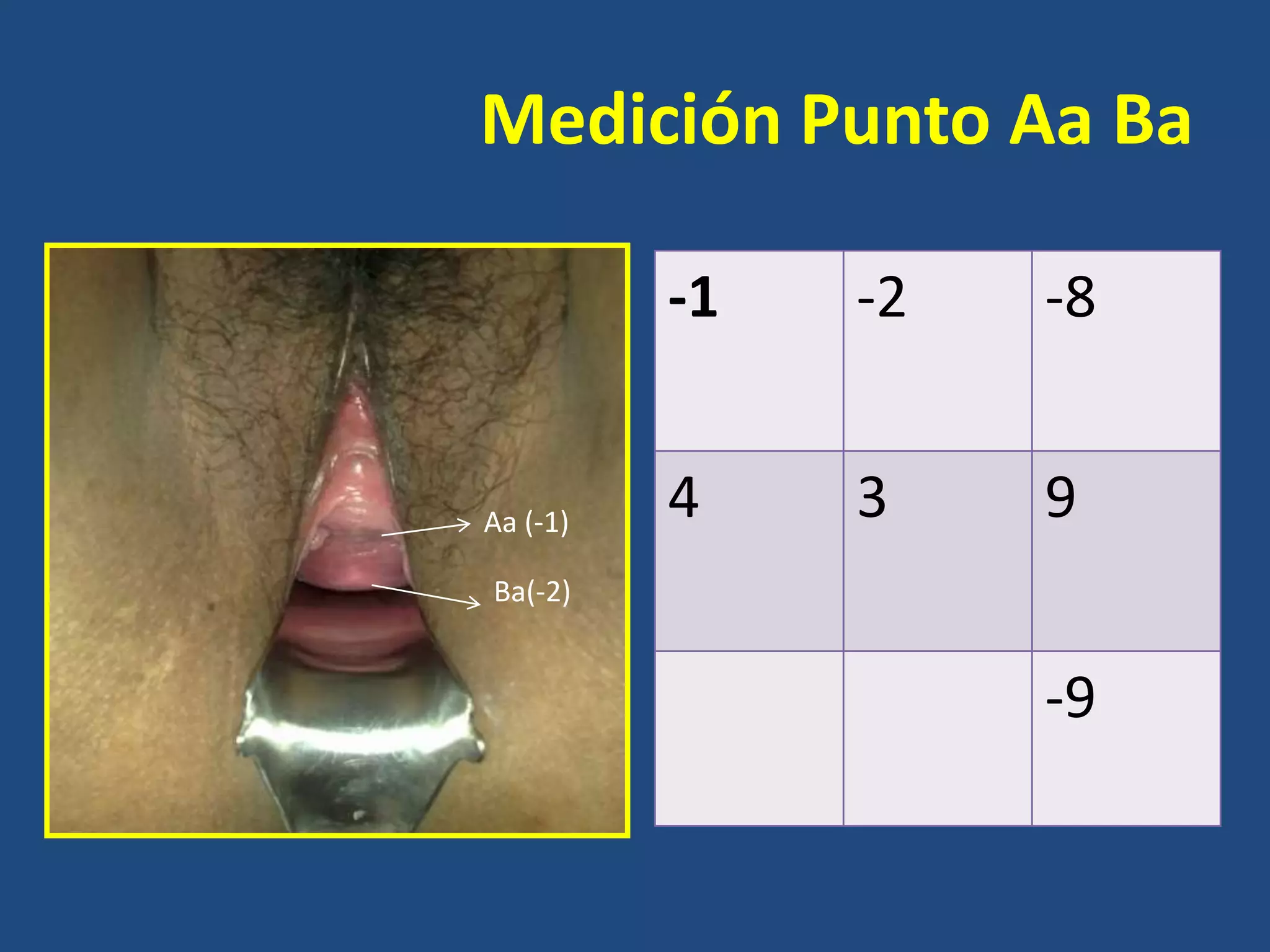 Medición Punto Aa Ba
-1

Aa (-1)

-2

-8

4

3

9

Ba(-2)

-9

 