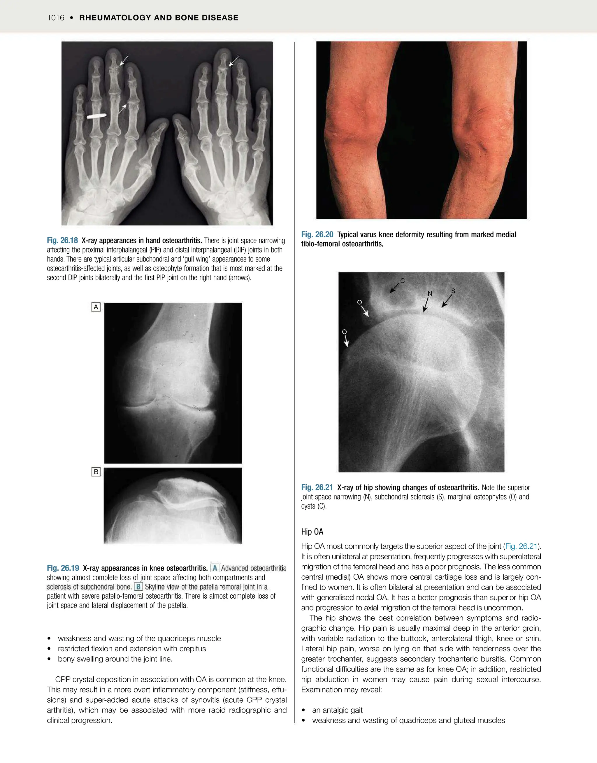DavidsonMedicine24th.pdf for medicine 4th year
