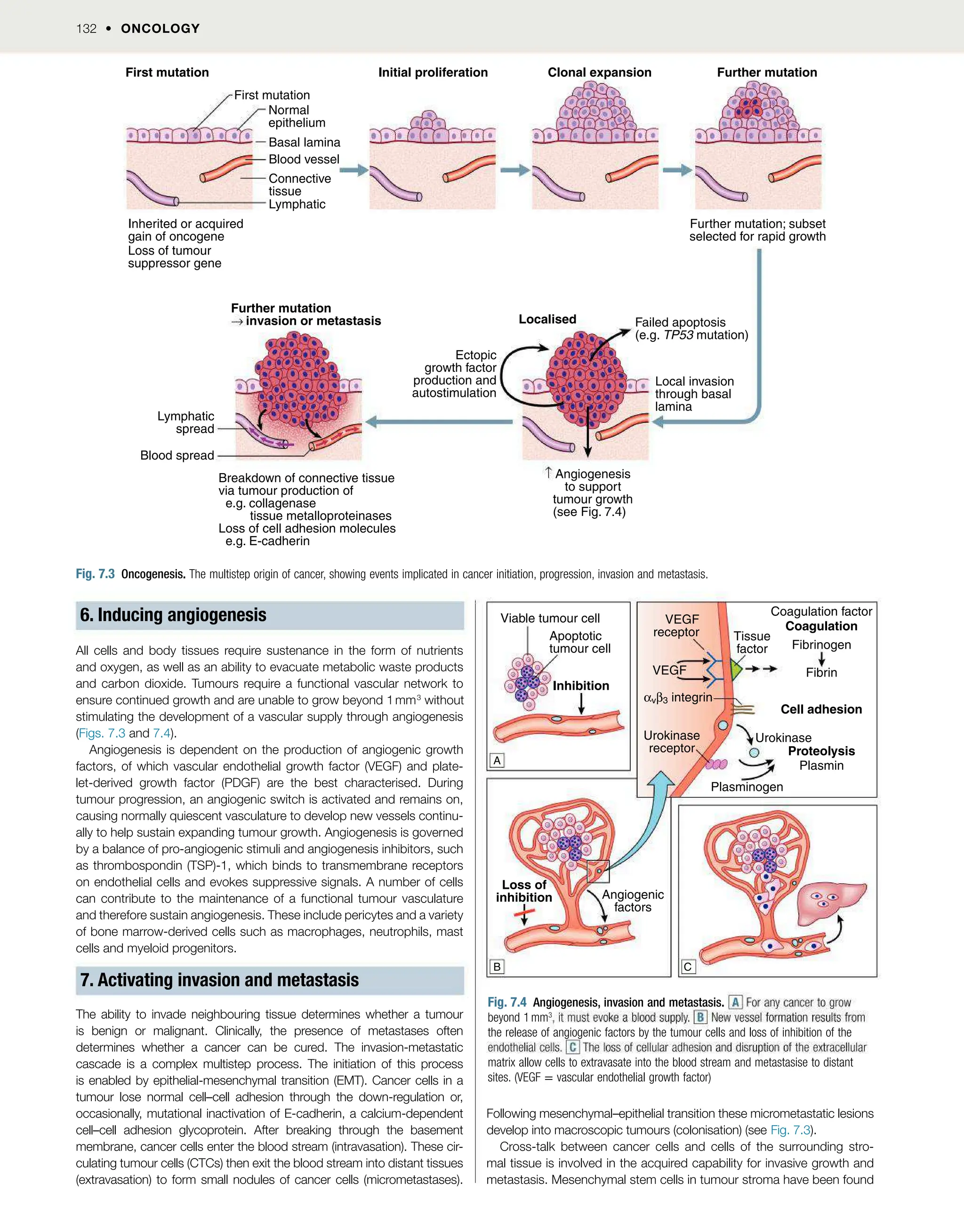 132  OncOlOgy
6. Inducing angiogenesis
All cells and body tissues require sustenance in the form of nutrients
and oxygen, as well as an ability to evacuate metabolic waste products
and carbon dioxide. Tumours require a functional vascular network to
ensure continued growth and are unable to grow beyond 1mm3
without
stimulating the development of a vascular supply through angiogenesis
(Figs. 7.3 and 7.4).
Angiogenesis is dependent on the production of angiogenic growth
factors, of which vascular endothelial growth factor (VEGF) and plate-
let-derived growth factor (PDGF) are the best characterised. During
tumour progression, an angiogenic switch is activated and remains on,
causing normally quiescent vasculature to develop new vessels continu-
ally to help sustain expanding tumour growth. Angiogenesis is governed
by a balance of pro-angiogenic stimuli and angiogenesis inhibitors, such
as thrombospondin (TSP)-1, which binds to transmembrane receptors
on endothelial cells and evokes suppressive signals. A number of cells
can contribute to the maintenance of a functional tumour vasculature
and therefore sustain angiogenesis. These include pericytes and a variety
of bone marrow-derived cells such as macrophages, neutrophils, mast
cells and myeloid progenitors.
7. Activating invasion and metastasis
The ability to invade neighbouring tissue determines whether a tumour
is benign or malignant. Clinically, the presence of metastases often
determines whether a cancer can be cured. The invasion-metastatic
cascade is a complex multistep process. The initiation of this process
is enabled by epithelial-mesenchymal transition (EMT). Cancer cells in a
tumour lose normal cell–cell adhesion through the down-regulation or,
occasionally, mutational inactivation of E-cadherin, a calcium-dependent
cell–cell adhesion glycoprotein. After breaking through the basement
membrane, cancer cells enter the blood stream (intravasation). These cir-
culating tumour cells (CTCs) then exit the blood stream into distant tissues
(extravasation) to form small nodules of cancer cells (micrometastases).
Fig. 7.3 Oncogenesis. The multistep origin of cancer, showing events implicated in cancer initiation, progression, invasion and metastasis.
Basal lamina
First mutation
Inherited or acquired
gain of oncogene
Loss of tumour
suppressor gene
Normal
epithelium
Blood vessel
Connective
tissue
Lymphatic
First mutation
Initial proliferation Clonal expansion Further mutation
Further mutation; subset
selected for rapid growth
Localised
Further mutation
Blood spread
Lymphatic
spread
Ectopic
growth factor
production and
autostimulation
Failed apoptosis
(e.g. TP53 mutation)
Local invasion
through basal
lamina
Angiogenesis
to support
tumour growth
(see Fig. 7.4)
Breakdown of connective tissue
via tumour production of
e.g. collagenase
tissue metalloproteinases
Loss of cell adhesion molecules
e.g. E-cadherin
invasion or metastasis
Inhibition
Loss of
inhibition
Viable tumour cell
Apoptotic
tumour cell
Angiogenic
factors
VEGF
VEGF
receptor Tissue
factor
αvβ3 integrin
Plasminogen
Coagulation factor
Coagulation
Fibrinogen
Fibrin
Cell adhesion
Urokinase
Urokinase
receptor Proteolysis
Plasmin
A
B C
Fig. 7.4 Angiogenesis, invasion and metastasis.
beyond 1mm3
the release of angiogenic factors by the tumour cells and loss of inhibition of the
matrix allow cells to extravasate into the blood stream and metastasise to distant
sites. (VEGF = vascular endothelial growth factor)
Following mesenchymal–epithelial transition these micrometastatic lesions
develop into macroscopic tumours (colonisation) (see Fig. 7.3).
Cross-talk between cancer cells and cells of the surrounding stro-
mal tissue is involved in the acquired capability for invasive growth and
metastasis. Mesenchymal stem cells in tumour stroma have been found
 