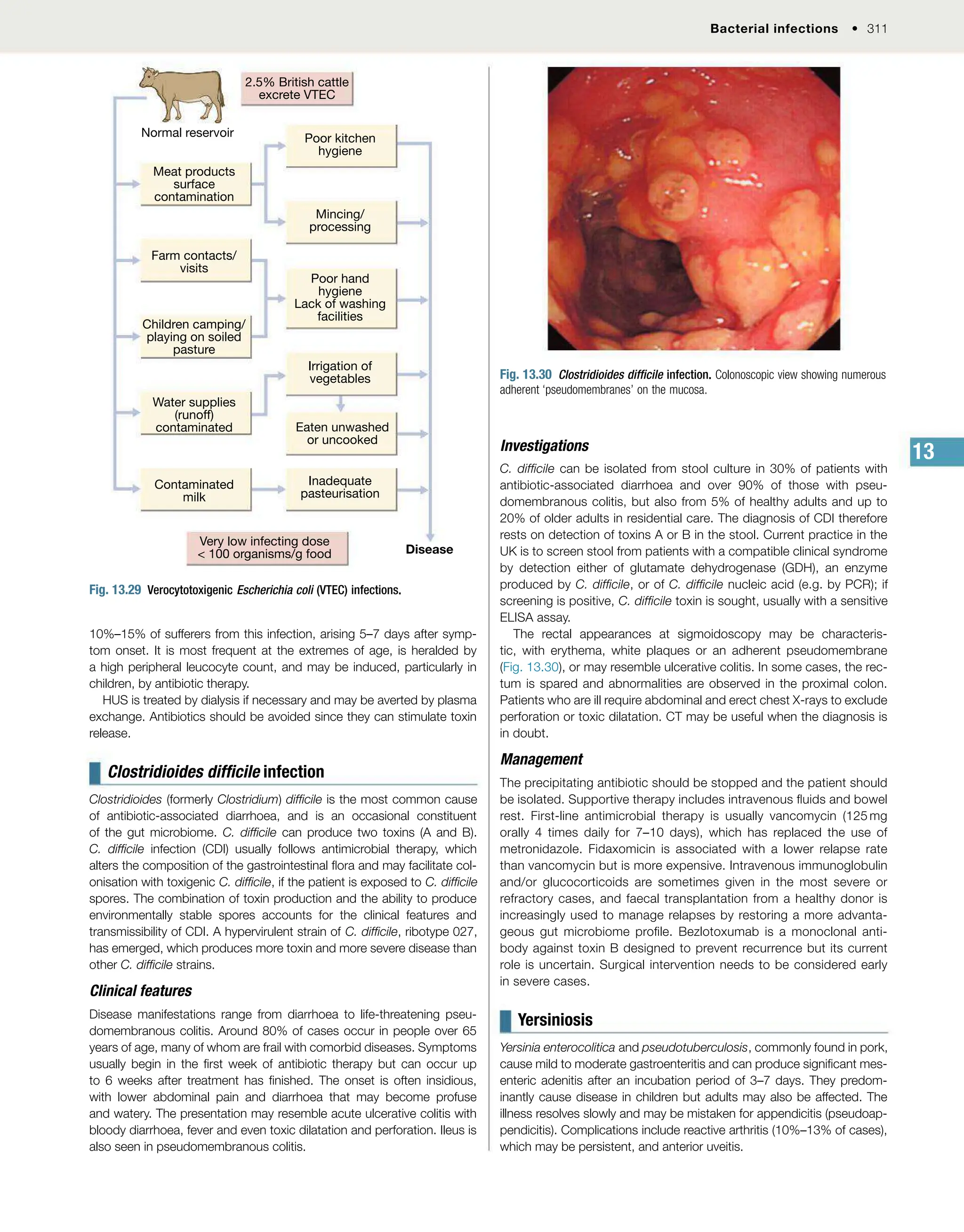 DavidsonMedicine24th.pdf for medicine 4th year