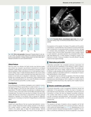 DavidsonMedicine24th.pdf for medicine 4th year
