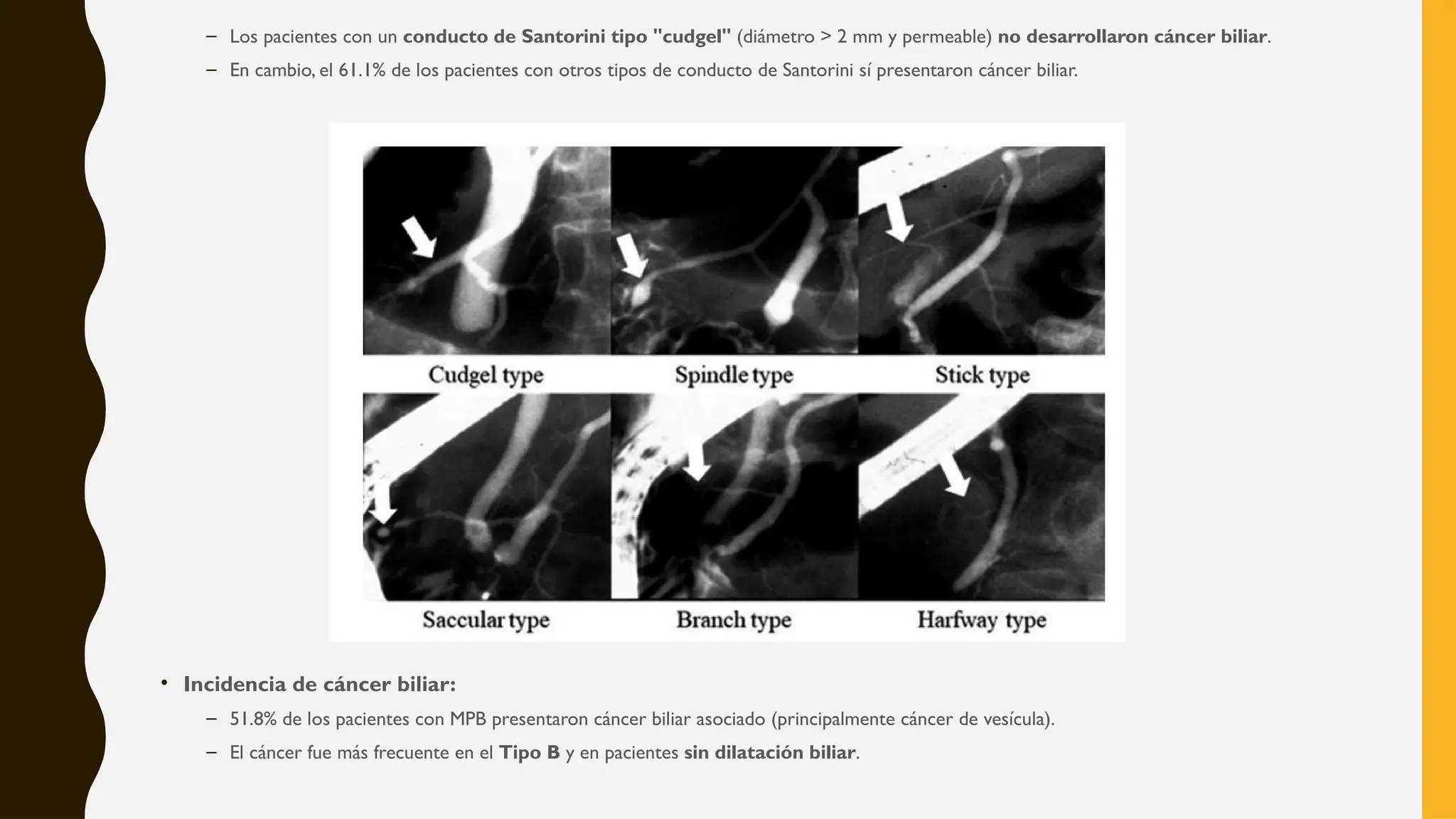 – Los pacientes con un conducto de Santorini tipo "cudgel" (diámetro > 2 mm y permeable) no desarrollaron cáncer biliar.
– En cambio, el 61.1% de los pacientes con otros tipos de conducto de Santorini sí presentaron cáncer biliar.
• Incidencia de cáncer biliar:
– 51.8% de los pacientes con MPB presentaron cáncer biliar asociado (principalmente cáncer de vesícula).
– El cáncer fue más frecuente en el Tipo B y en pacientes sin dilatación biliar.
 
