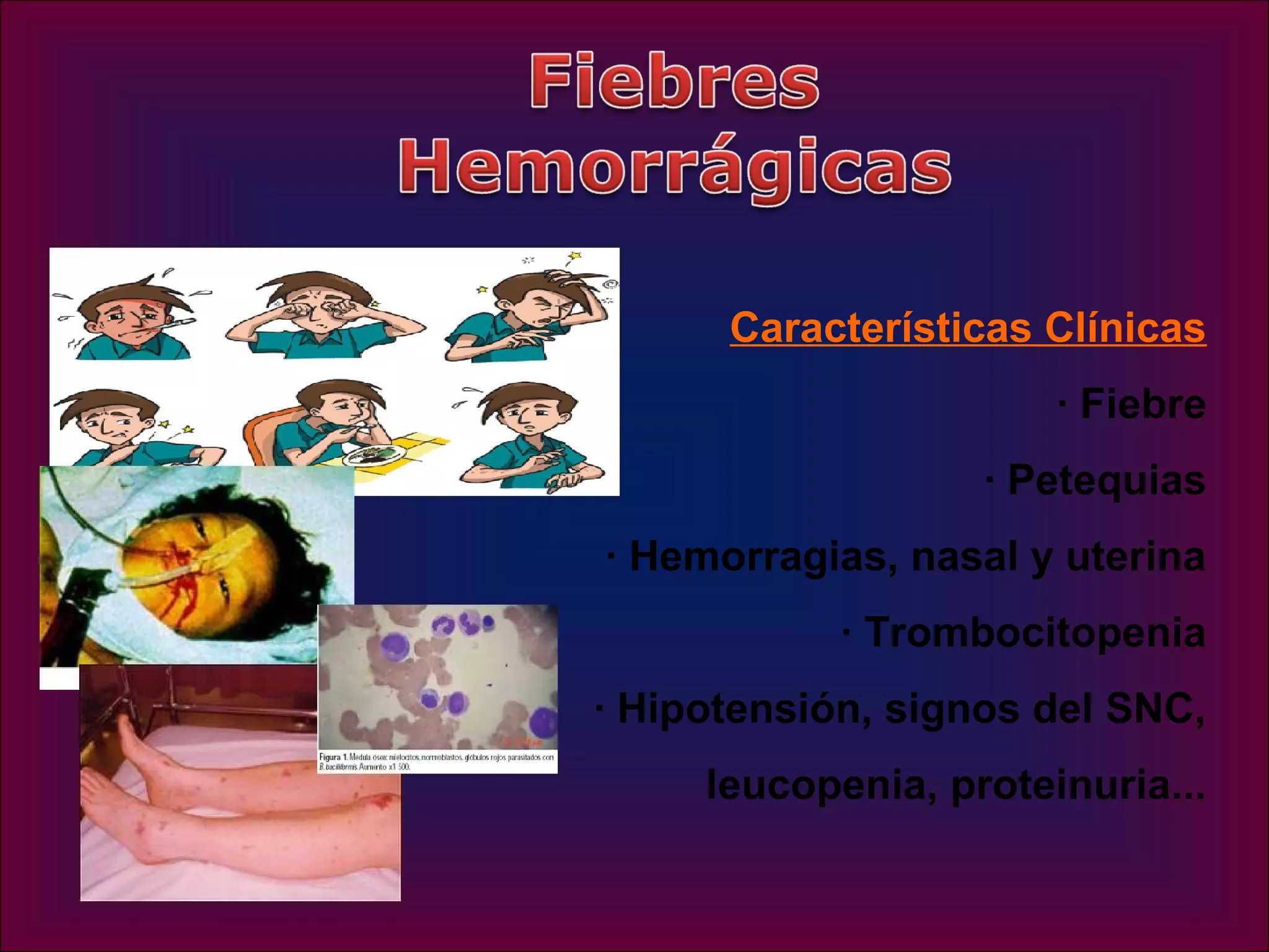 Características Clínicas
                       · Fiebre
                   · Petequias
· Hemorragias, nasal y uterina
            · Trombocitopenia
· Hipotensión, signos del SNC,
     leucopenia, proteinuria...
 