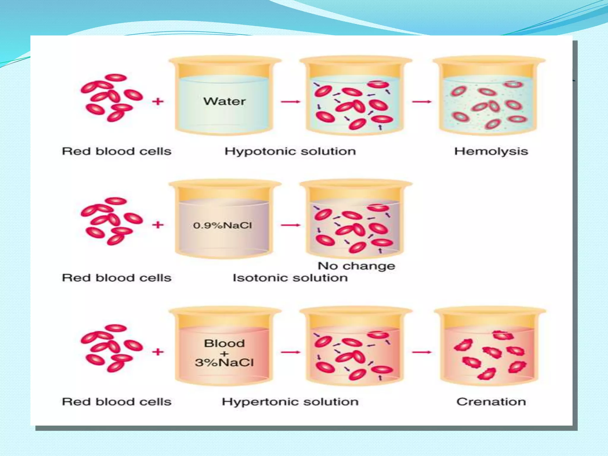 2) Imbalance due disturbances in
concentration:
Normal level of sodium is 135-145 mmol/l
• Prime determinant of ECF volume, 90% of osmolality.
• Water always follows Na
• Na increases – ECF increases
• Na decreases – ECF decreases
• No known to mechanism to regulate intake
• Output regulated by:
a. Aldosterone
b. Renal blood flow
c. Renin secretion
d. Antidiuretic hormone (ADH) due to its effect on water
 
