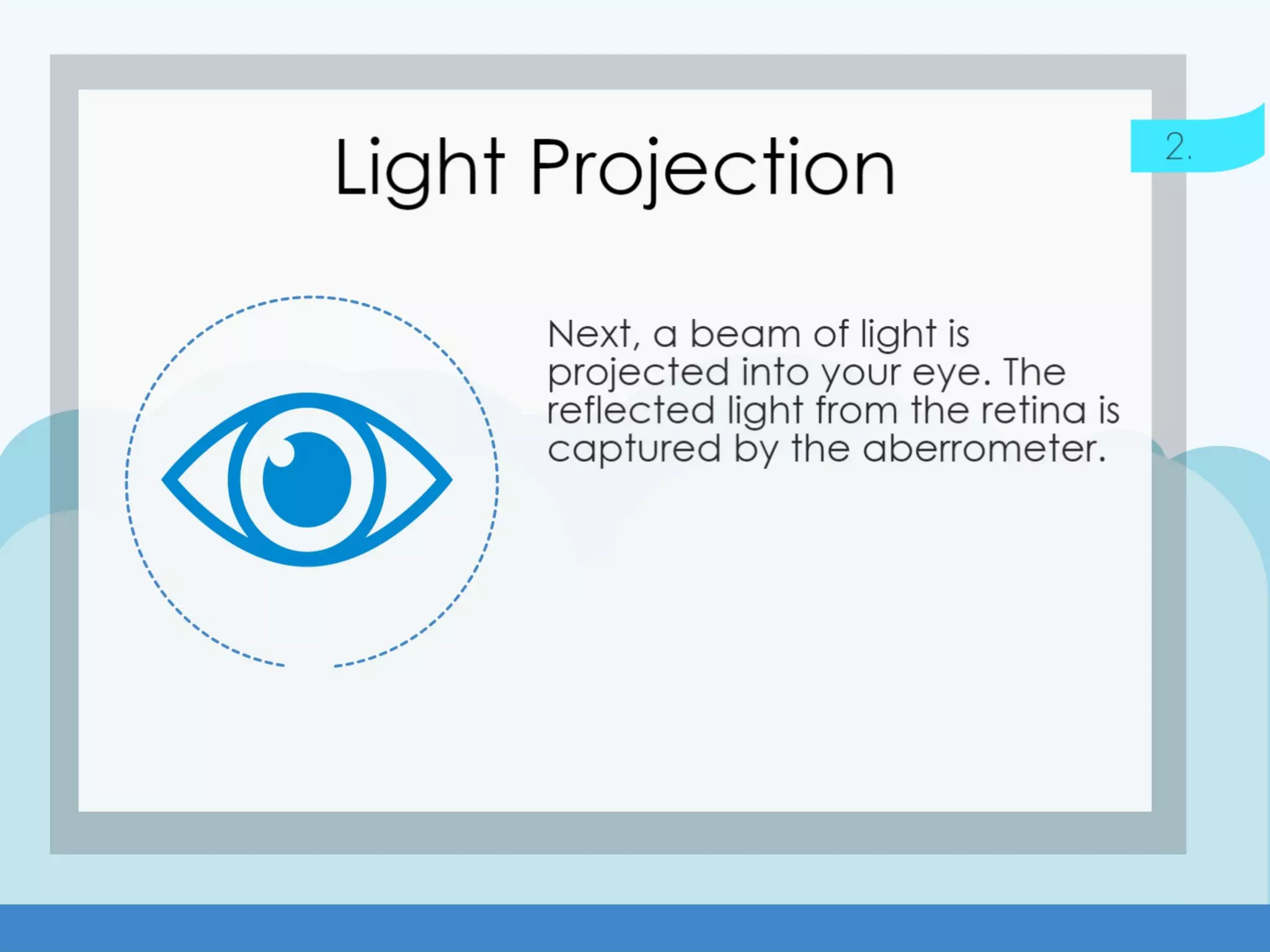 Wavefront LASIK: The Process