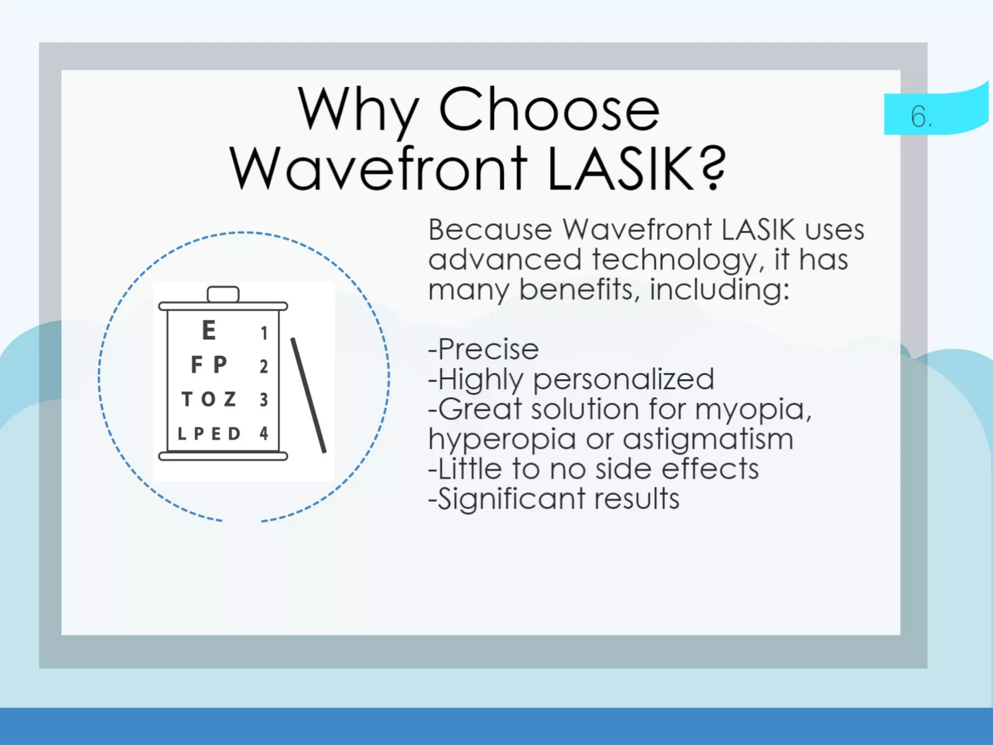 Wavefront LASIK: The Process