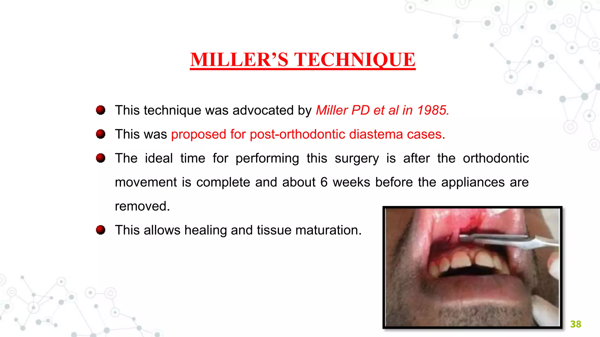 38
MILLER’S TECHNIQUE
This technique was advocated by Miller PD et al in 1985.
This was proposed for post-orthodontic diastema cases.
The ideal time for performing this surgery is after the orthodontic
movement is complete and about 6 weeks before the appliances are
removed.
This allows healing and tissue maturation.
 