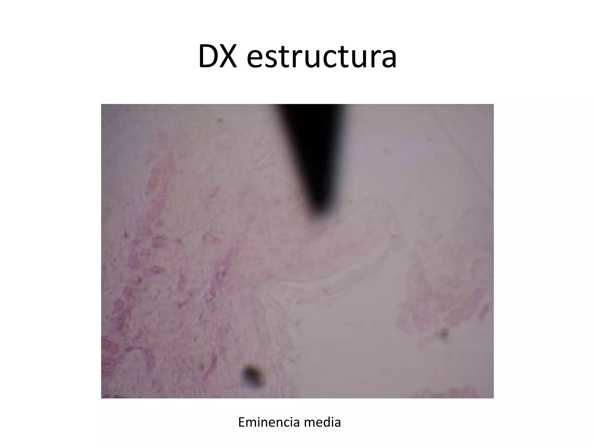 DX estructura

Eminencia media

 