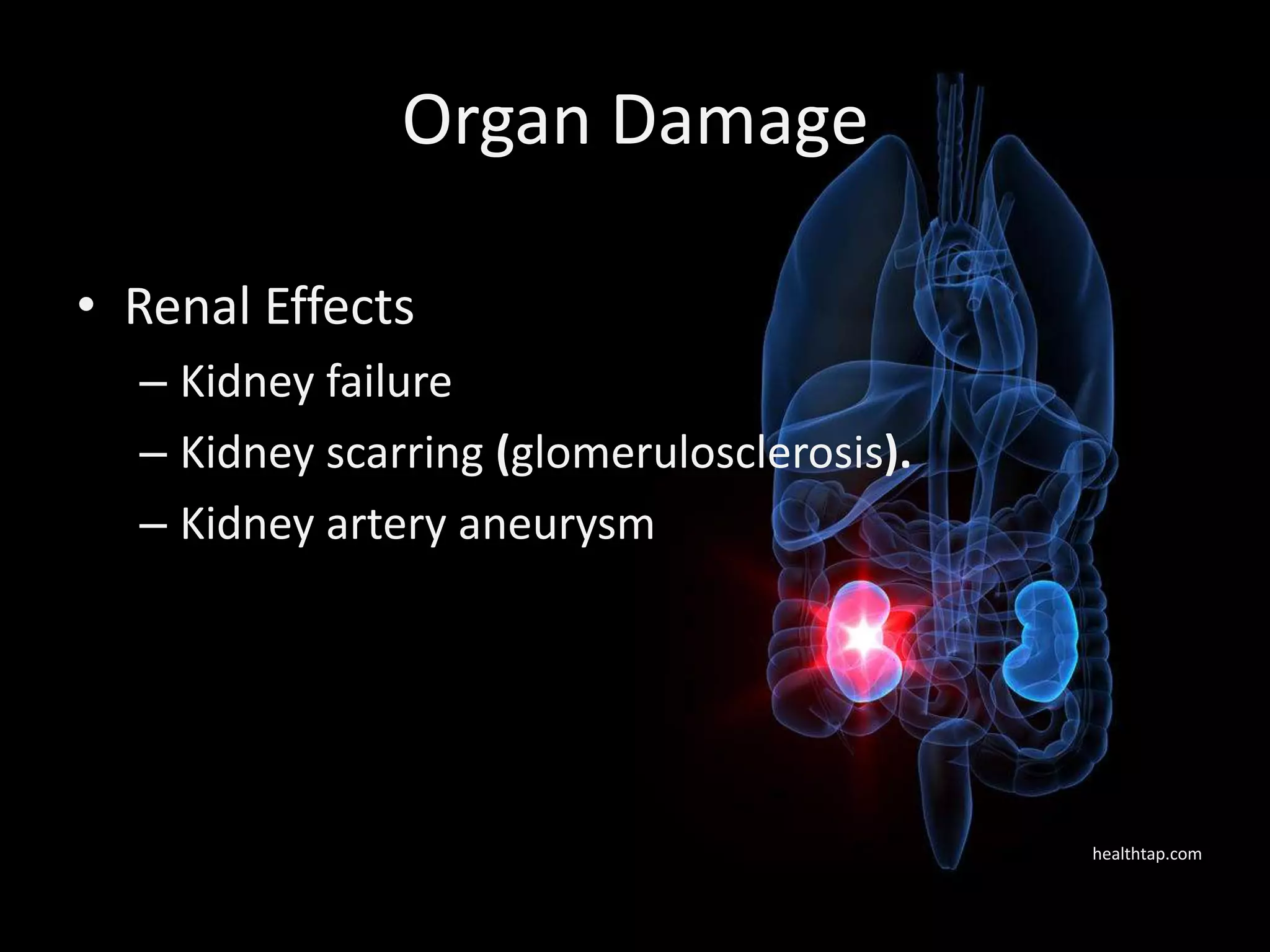 Organ Damage

• Renal Effects
  – Kidney failure
  – Kidney scarring (glomerulosclerosis).
  – Kidney artery aneurysm




                                            healthtap.com
 