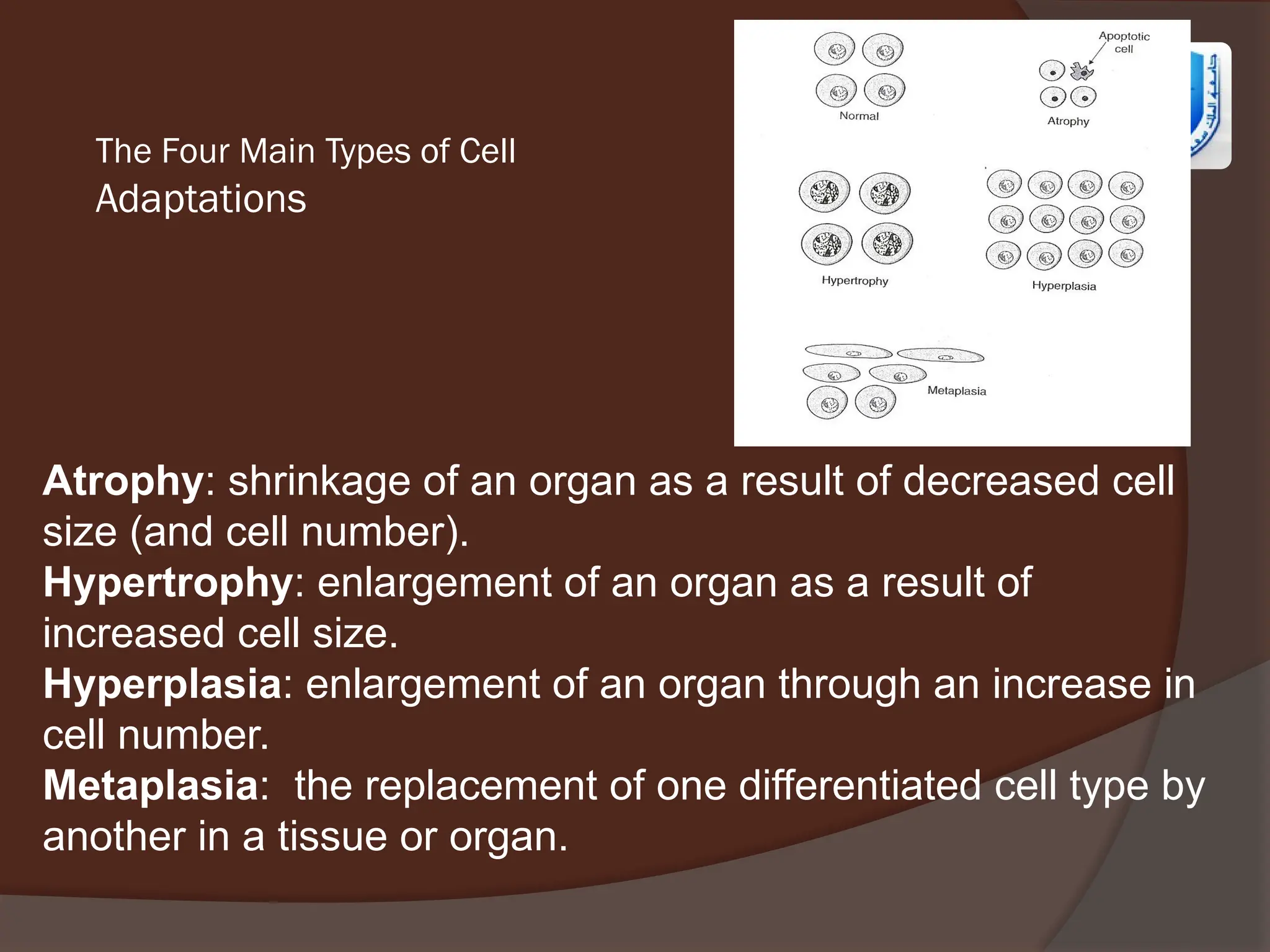 The Four Main Types of Cell
Adaptations
Atrophy: shrinkage of an organ as a result of decreased cell
size (and cell number).
Hypertrophy: enlargement of an organ as a result of
increased cell size.
Hyperplasia: enlargement of an organ through an increase in
cell number.
Metaplasia: the replacement of one differentiated cell type by
another in a tissue or organ.
 