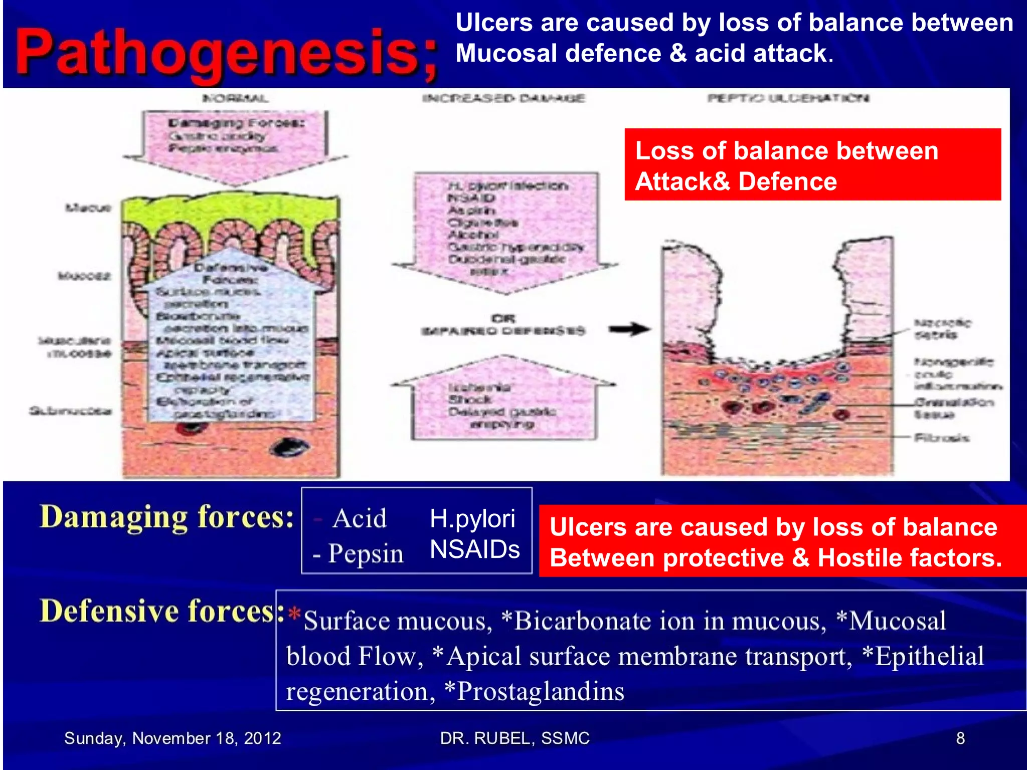 Ulcers are caused by loss of balance between
Mucosal defence & acid attack.

Loss of balance between
Attack& Defence

H.pylori
NSAIDs

Ulcers are caused by loss of balance
Between protective & Hostile factors.

 