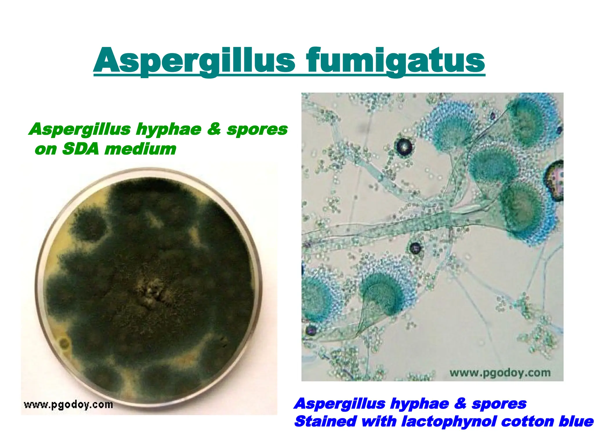 Aspergillus fumigatus
Aspergillus hyphae & spores
on SDA medium
Aspergillus hyphae & spores
Stained with lactophynol cotton blue
 