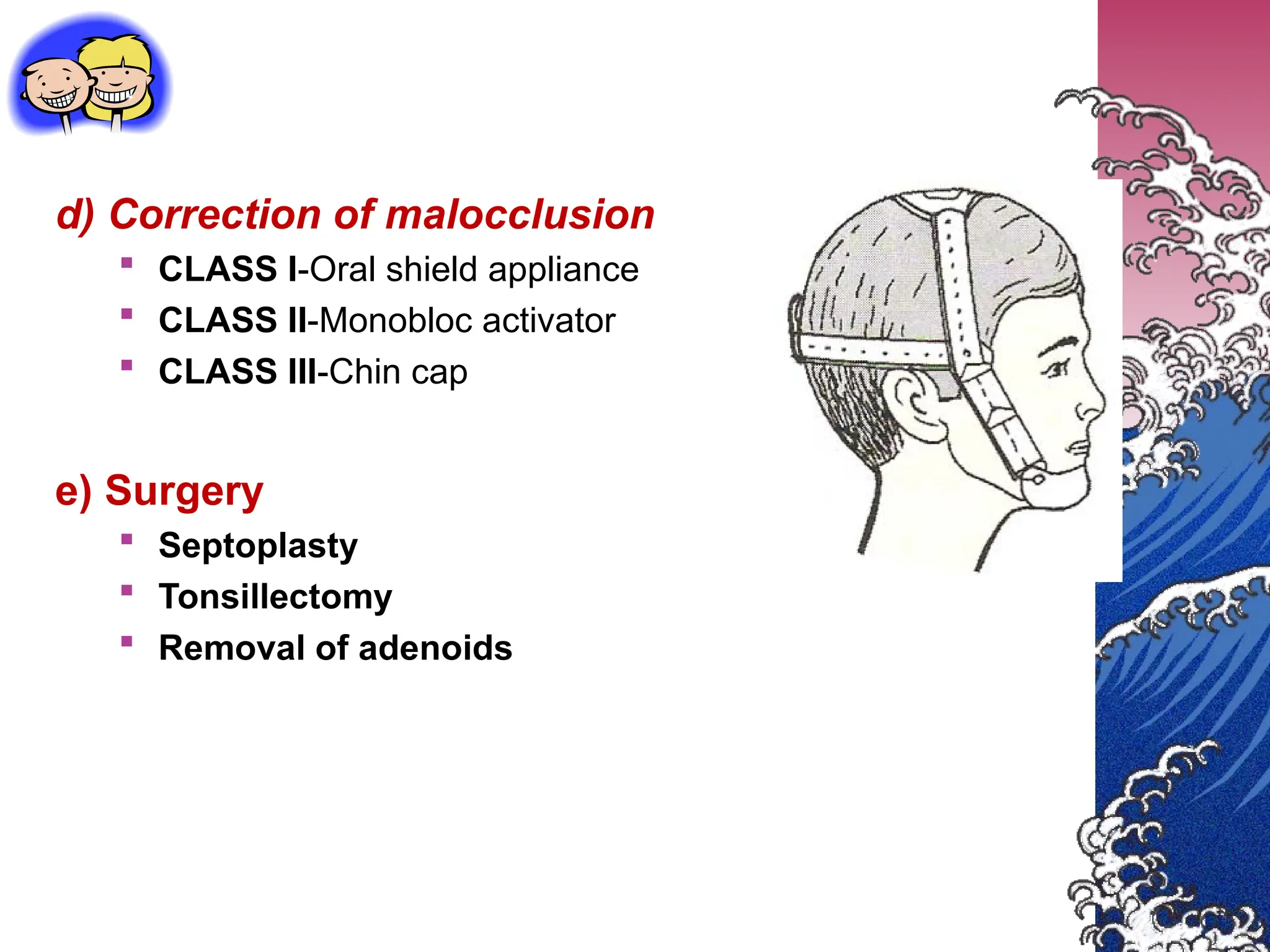 d) Correction of malocclusion
 CLASS I-Oral shield appliance
 CLASS II-Monobloc activator
 CLASS III-Chin cap
e) Surgery
 Septoplasty
 Tonsillectomy
 Removal of adenoids
 