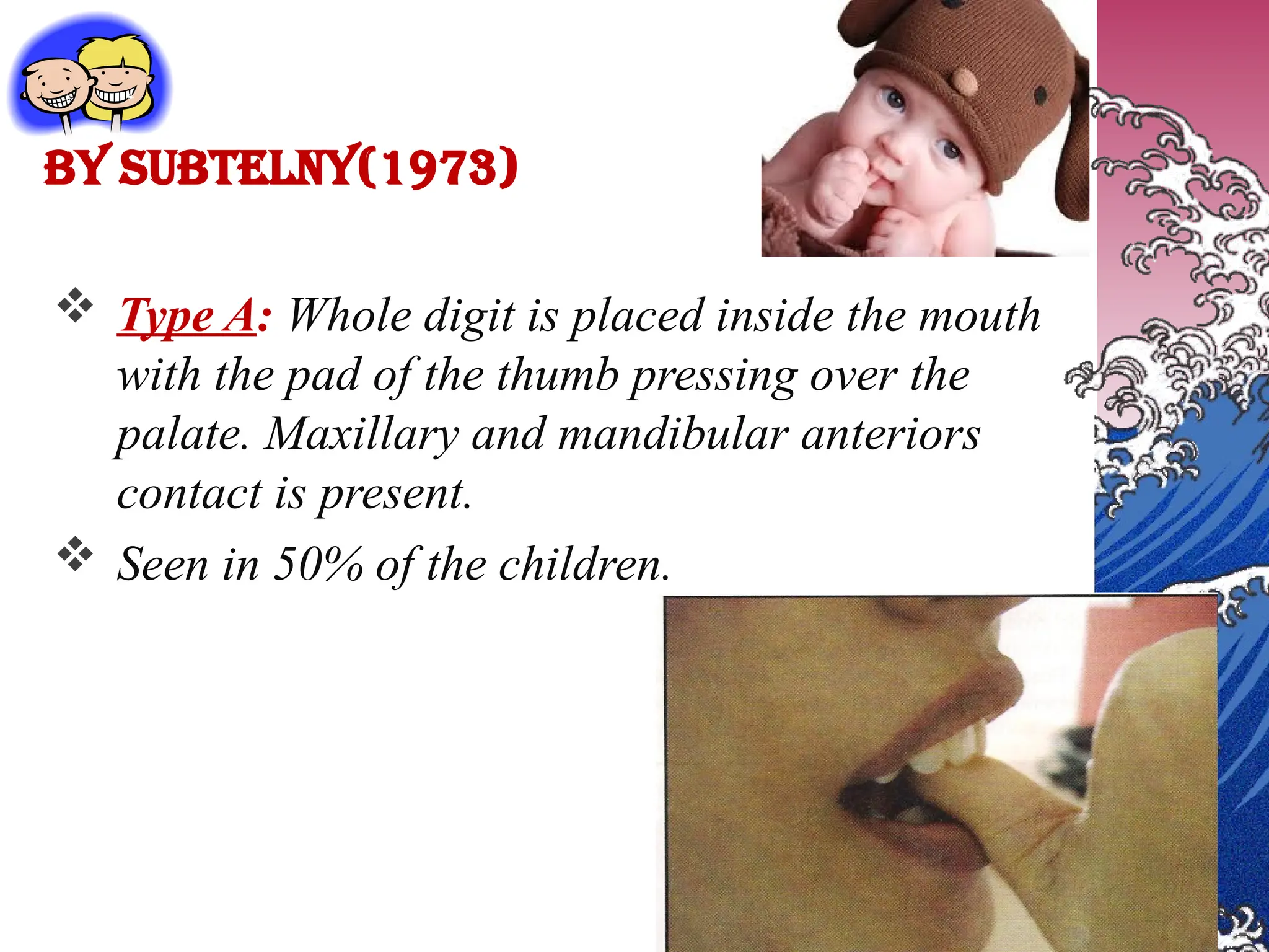 By subtelny(1973)
 Type A: Whole digit is placed inside the mouth
with the pad of the thumb pressing over the
palate. Maxillary and mandibular anteriors
contact is present.
 Seen in 50% of the children.
 