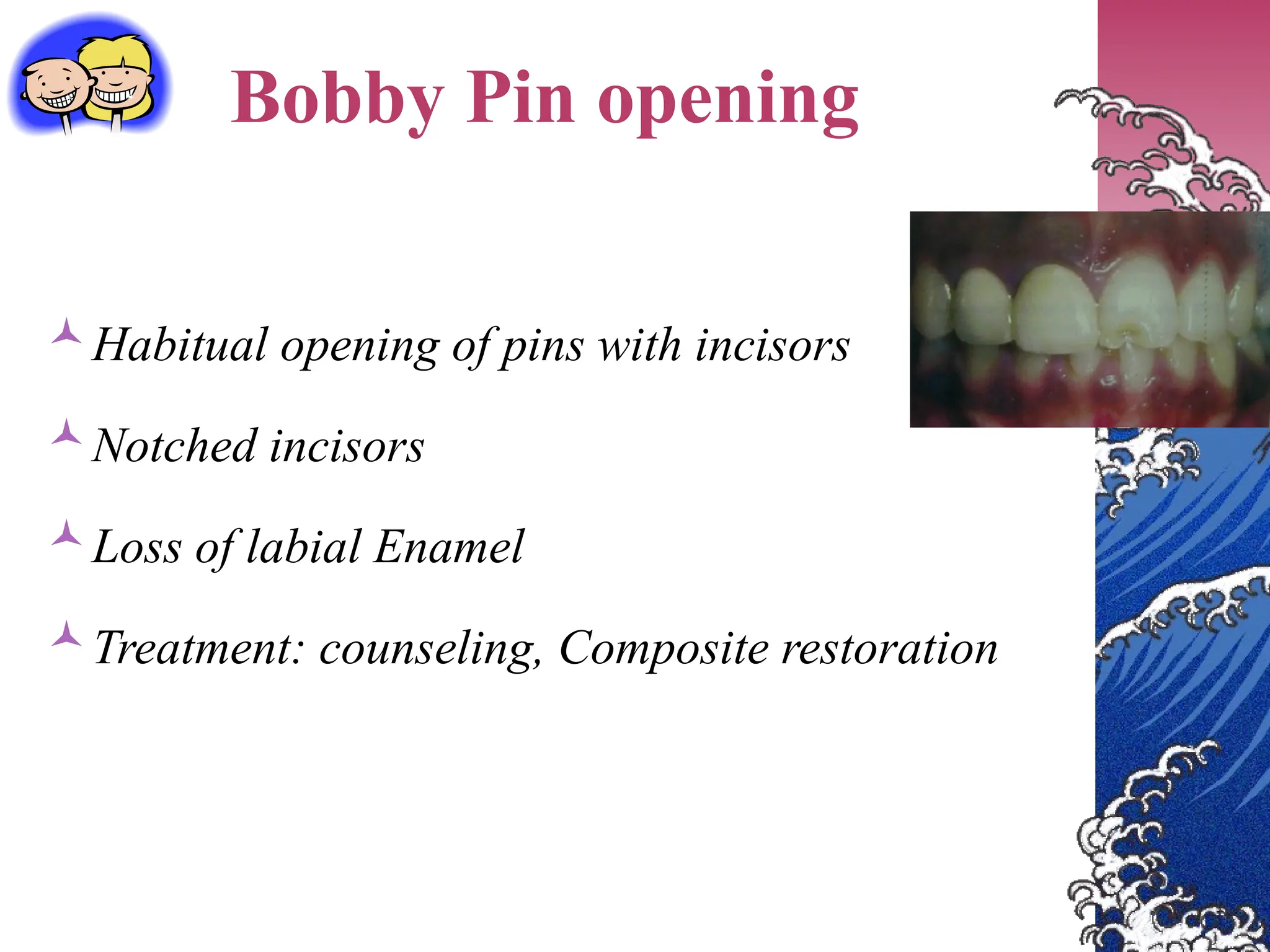 Bobby Pin opening
Habitual opening of pins with incisors
Notched incisors
Loss of labial Enamel
Treatment: counseling, Composite restoration
 