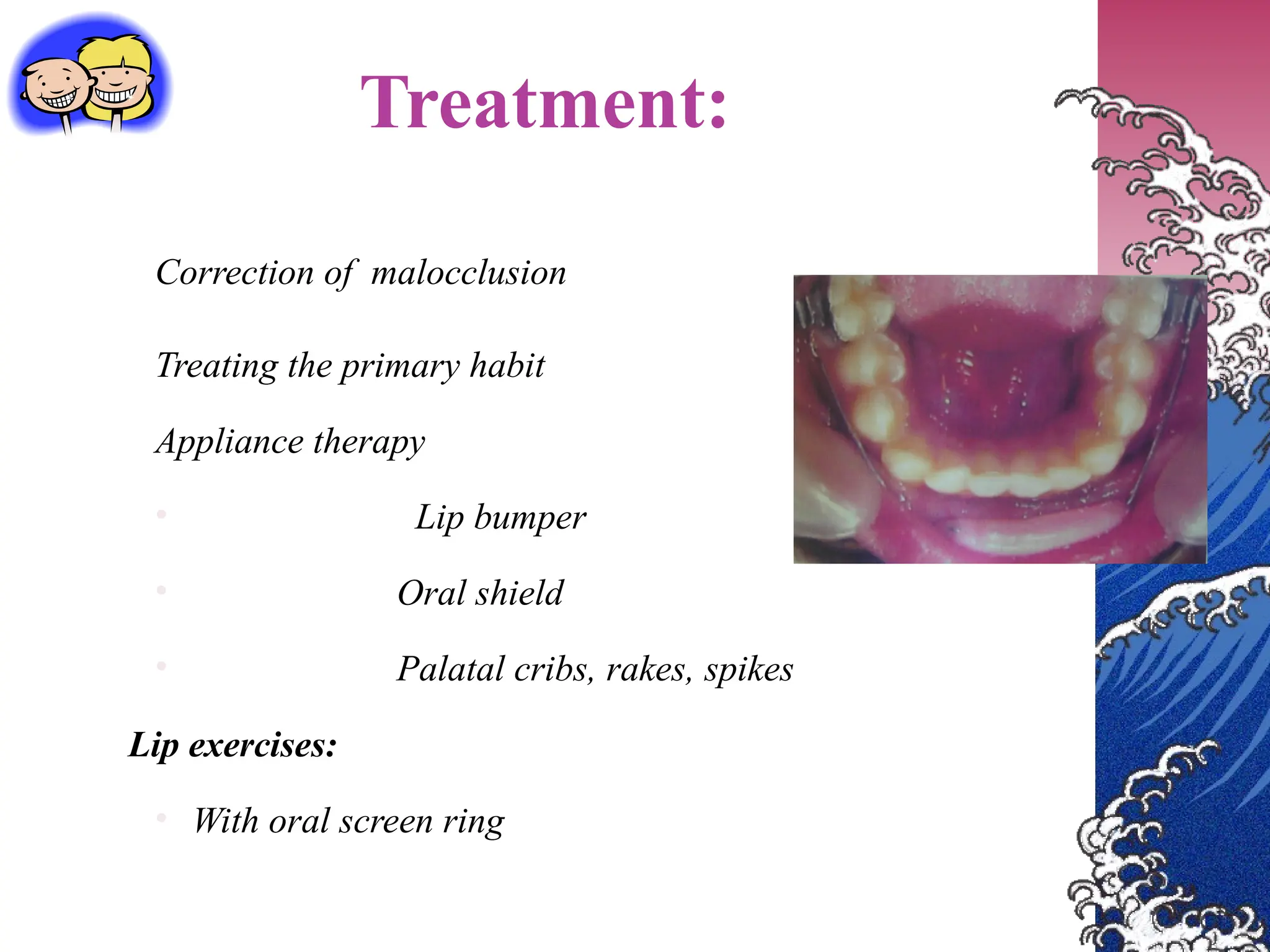 Treatment:
Correction of malocclusion
Treating the primary habit
Appliance therapy
• Lip bumper
• Oral shield
• Palatal cribs, rakes, spikes
Lip exercises:
• With oral screen ring
 