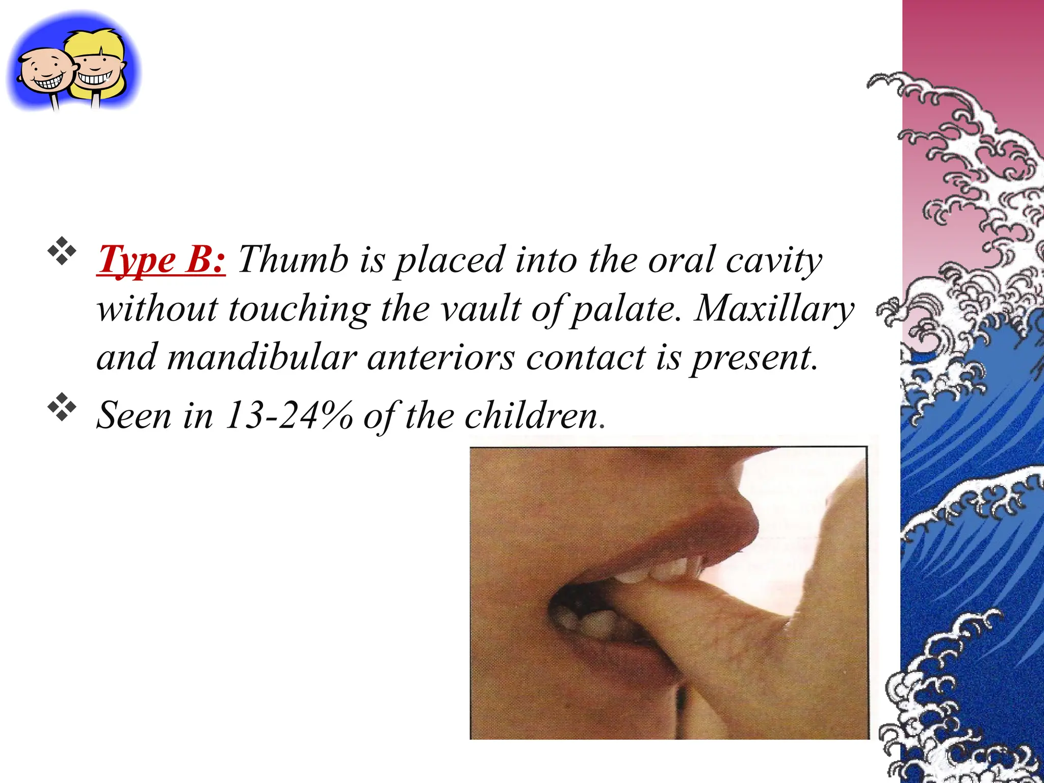  Type B: Thumb is placed into the oral cavity
without touching the vault of palate. Maxillary
and mandibular anteriors contact is present.
 Seen in 13-24% of the children.
 