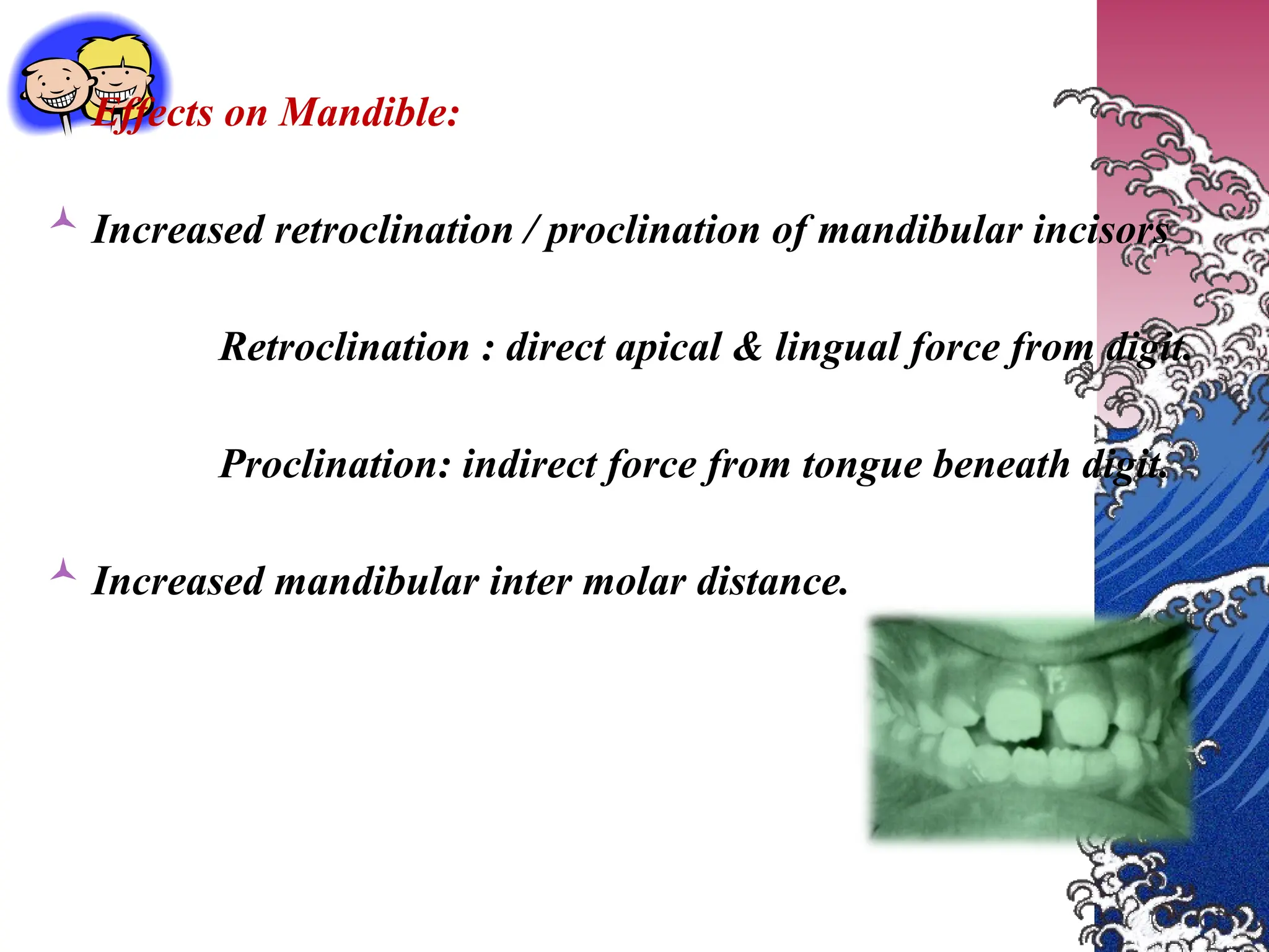 Effects on Mandible:
 Increased retroclination / proclination of mandibular incisors
Retroclination : direct apical & lingual force from digit.
Proclination: indirect force from tongue beneath digit.
 Increased mandibular inter molar distance.
 