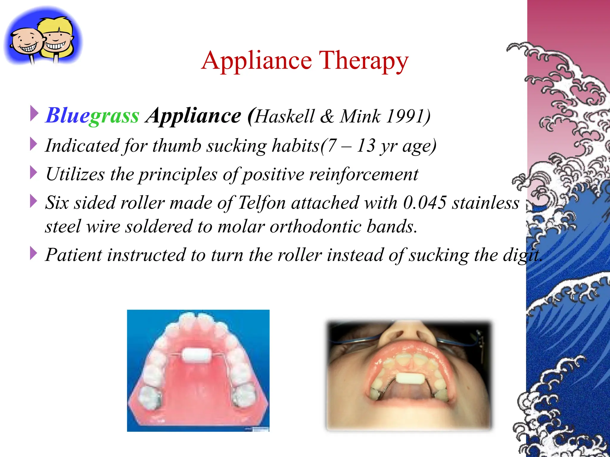 Bluegrass Appliance (Haskell & Mink 1991)
 Indicated for thumb sucking habits(7 – 13 yr age)
 Utilizes the principles of positive reinforcement
 Six sided roller made of Telfon attached with 0.045 stainless
steel wire soldered to molar orthodontic bands.
 Patient instructed to turn the roller instead of sucking the digit.
Appliance Therapy
 