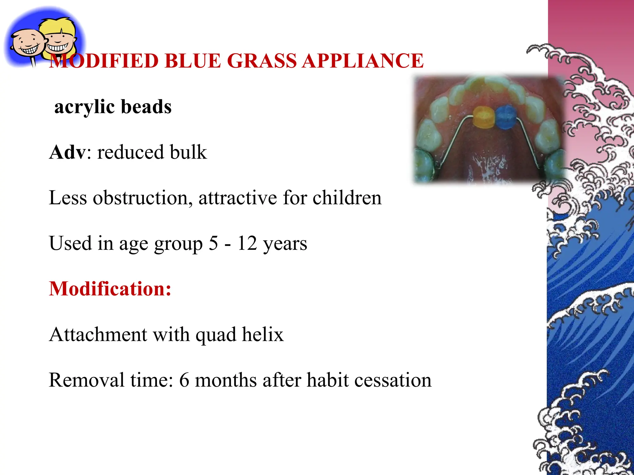 MODIFIED BLUE GRASS APPLIANCE
acrylic beads
Adv: reduced bulk
Less obstruction, attractive for children
Used in age group 5 - 12 years
Modification:
Attachment with quad helix
Removal time: 6 months after habit cessation
 