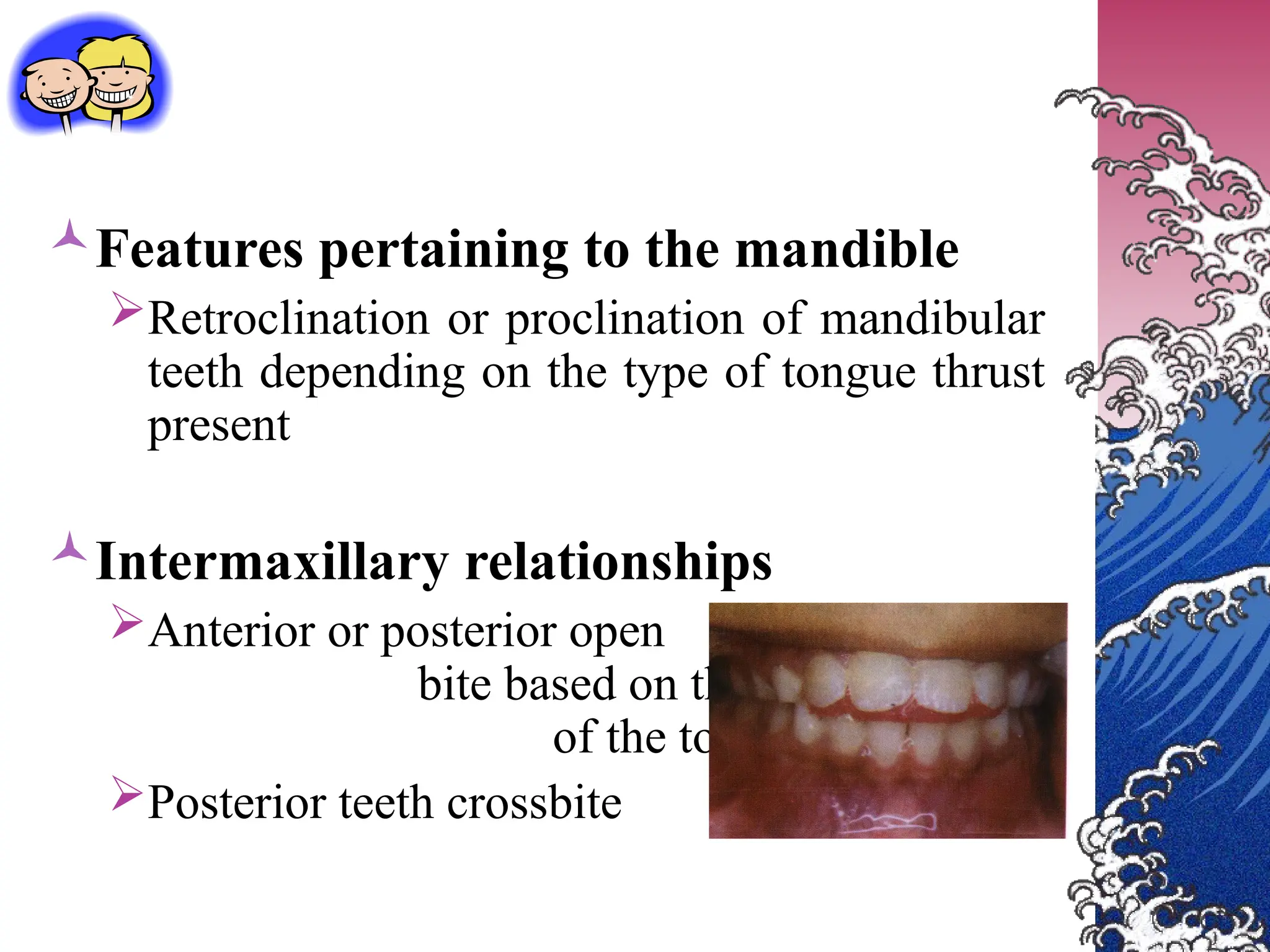 Features pertaining to the mandible
Retroclination or proclination of mandibular
teeth depending on the type of tongue thrust
present
Intermaxillary relationships
Anterior or posterior open
bite based on the posture
of the tongue
Posterior teeth crossbite
 