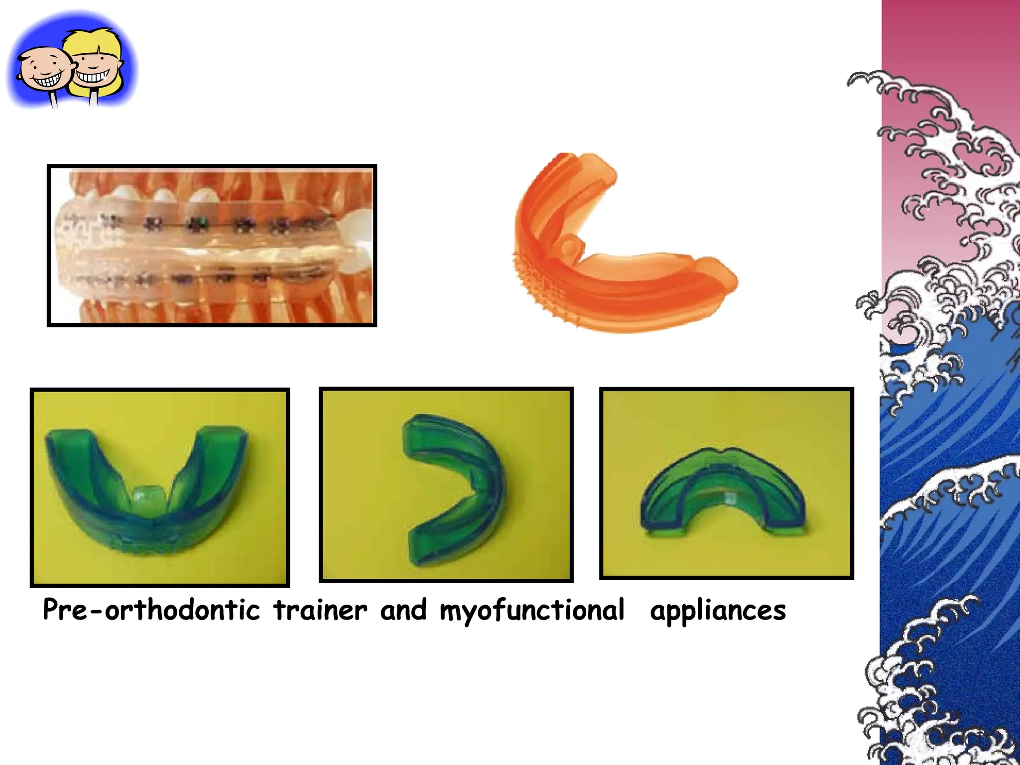 Pre-orthodontic trainer and myofunctional appliances
 