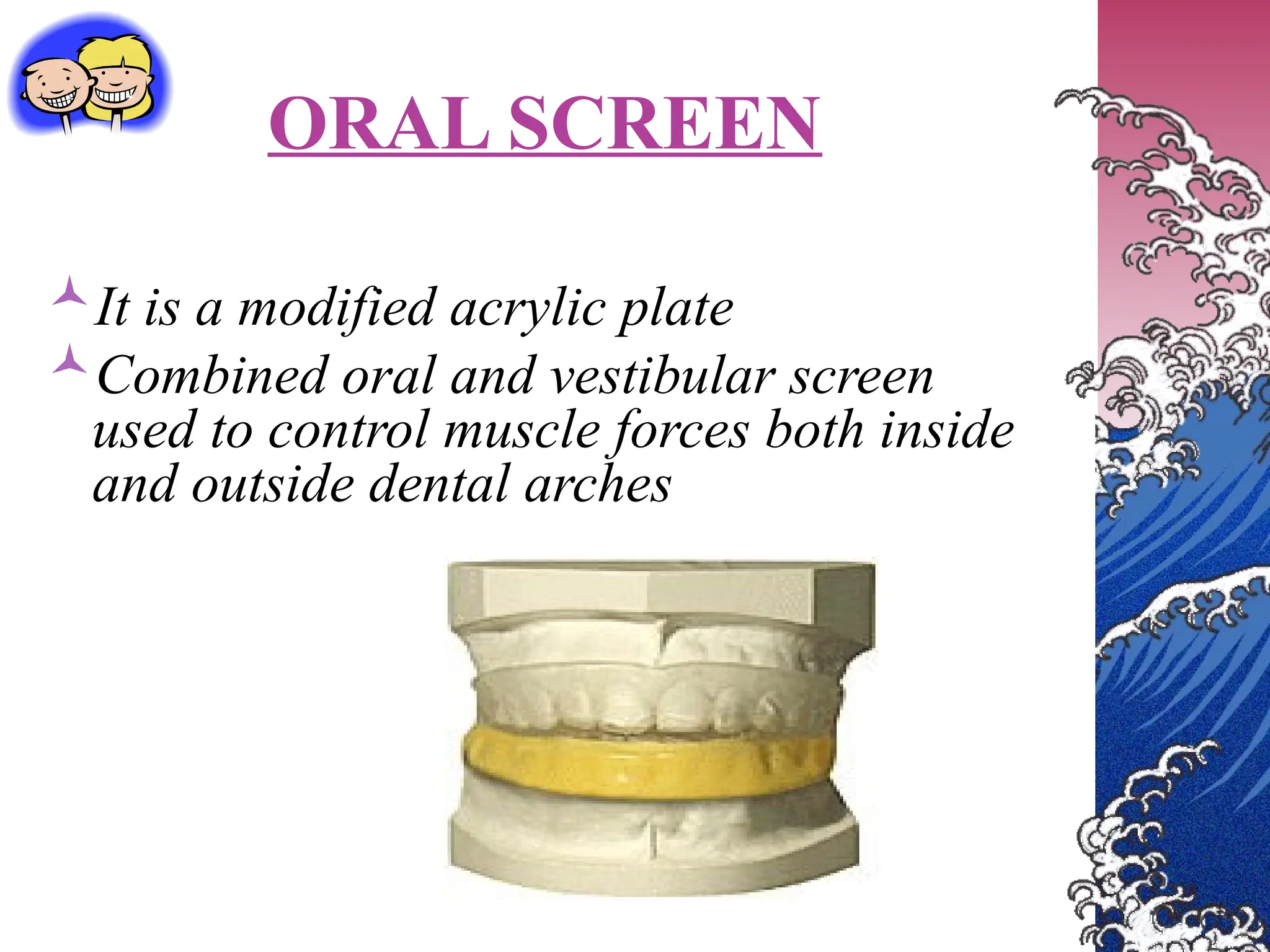 ORAL SCREEN
It is a modified acrylic plate
Combined oral and vestibular screen
used to control muscle forces both inside
and outside dental arches
 