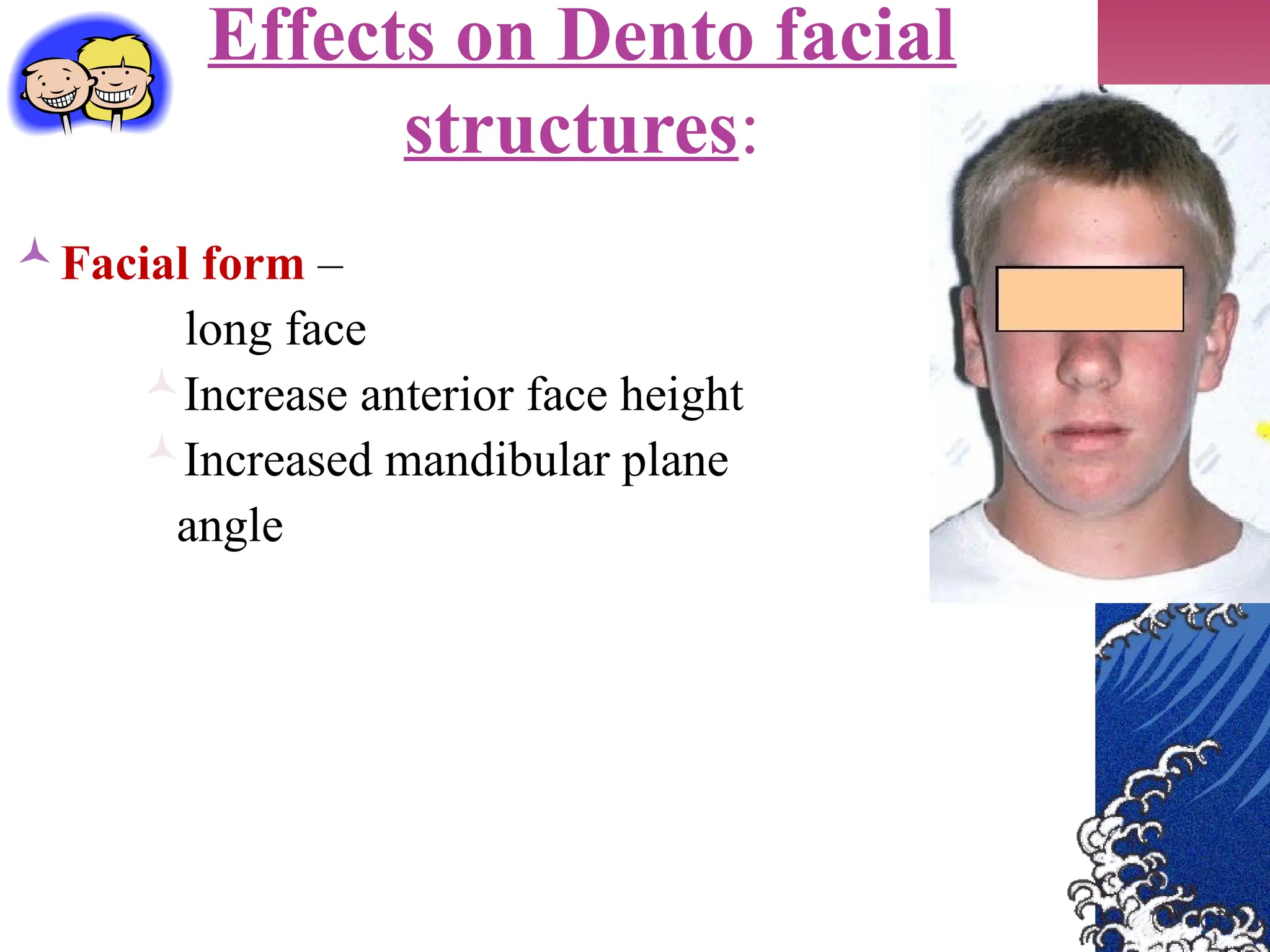 Effects on Dento facial
structures:
Facial form –
long face
Increase anterior face height
Increased mandibular plane
angle
 