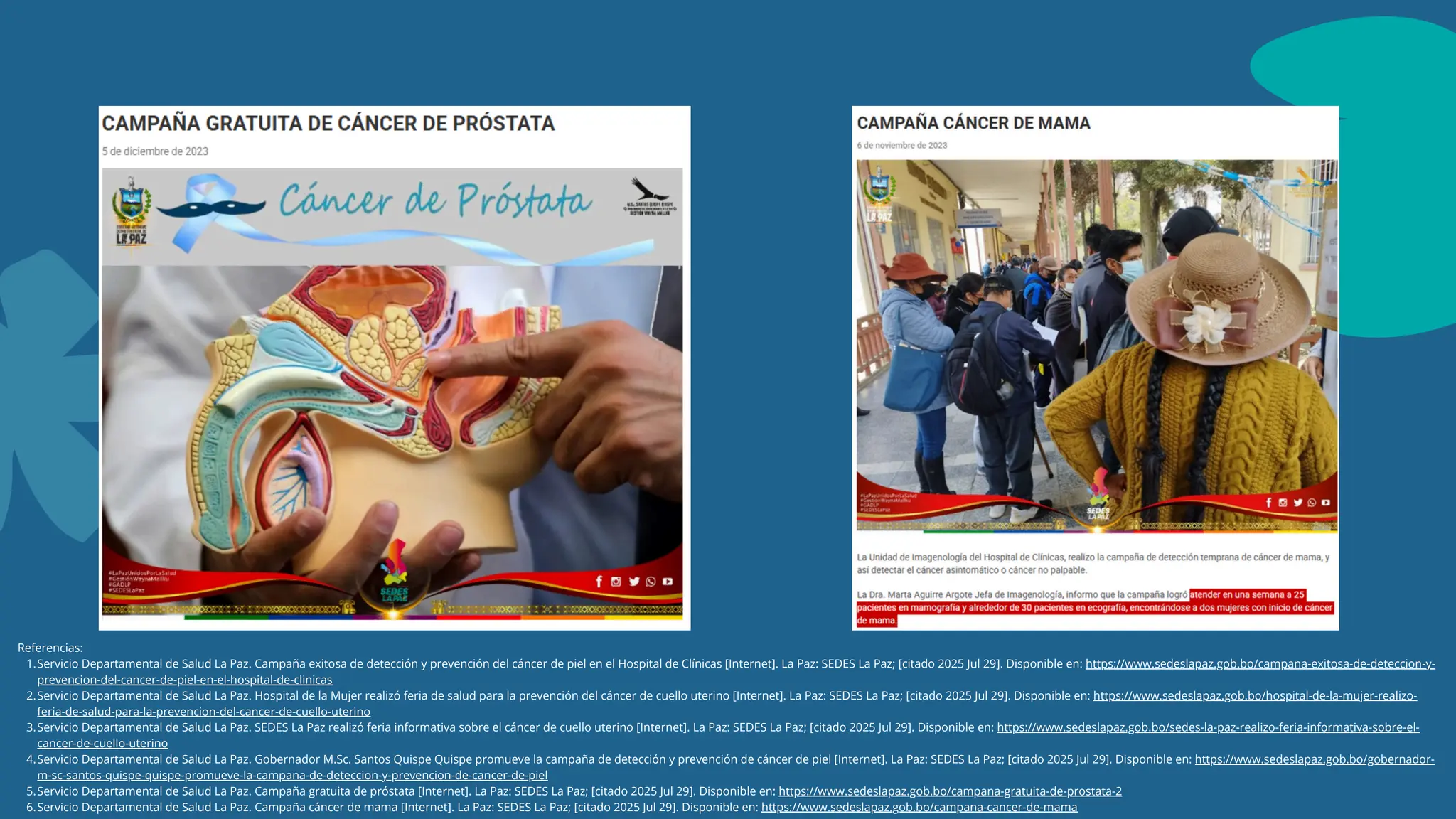 Referencias:
1.Servicio Departamental de Salud La Paz. Campaña exitosa de detección y prevención del cáncer de piel en el Hospital de Clínicas [Internet]. La Paz: SEDES La Paz; [citado 2025 Jul 29]. Disponible en: https://www.sedeslapaz.gob.bo/campana-exitosa-de-deteccion-y-
prevencion-del-cancer-de-piel-en-el-hospital-de-clinicas
2.Servicio Departamental de Salud La Paz. Hospital de la Mujer realizó feria de salud para la prevención del cáncer de cuello uterino [Internet]. La Paz: SEDES La Paz; [citado 2025 Jul 29]. Disponible en: https://www.sedeslapaz.gob.bo/hospital-de-la-mujer-realizo-
feria-de-salud-para-la-prevencion-del-cancer-de-cuello-uterino
3.Servicio Departamental de Salud La Paz. SEDES La Paz realizó feria informativa sobre el cáncer de cuello uterino [Internet]. La Paz: SEDES La Paz; [citado 2025 Jul 29]. Disponible en: https://www.sedeslapaz.gob.bo/sedes-la-paz-realizo-feria-informativa-sobre-el-
cancer-de-cuello-uterino
4.Servicio Departamental de Salud La Paz. Gobernador M.Sc. Santos Quispe Quispe promueve la campaña de detección y prevención de cáncer de piel [Internet]. La Paz: SEDES La Paz; [citado 2025 Jul 29]. Disponible en: https://www.sedeslapaz.gob.bo/gobernador-
m-sc-santos-quispe-quispe-promueve-la-campana-de-deteccion-y-prevencion-de-cancer-de-piel
5.Servicio Departamental de Salud La Paz. Campaña gratuita de próstata [Internet]. La Paz: SEDES La Paz; [citado 2025 Jul 29]. Disponible en: https://www.sedeslapaz.gob.bo/campana-gratuita-de-prostata-2
6.Servicio Departamental de Salud La Paz. Campaña cáncer de mama [Internet]. La Paz: SEDES La Paz; [citado 2025 Jul 29]. Disponible en: https://www.sedeslapaz.gob.bo/campana-cancer-de-mama
 