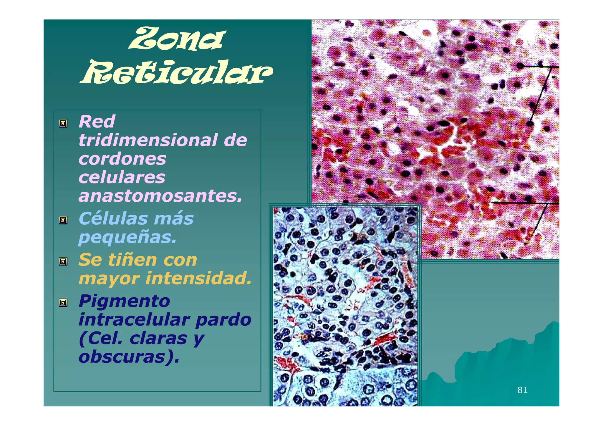 Zona
Reticular
Red
tridimensional de
cordones
celulares
anastomosantes.
Células más
pequeñas.
Se tiñen con
mayor intensidad.
Pigmento
intracelular pardo
(Cel. claras y
obscuras).
                     81
 