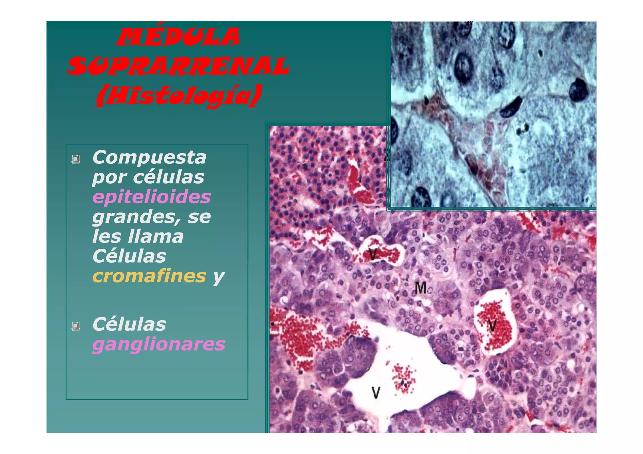 MÉDULA
SUPRARRENAL
 (Histología)

 Compuesta
 por células
 epitelioides
 grandes, se
 les llama
 Células
 cromafines y

 Células
 ganglionares


                83
 