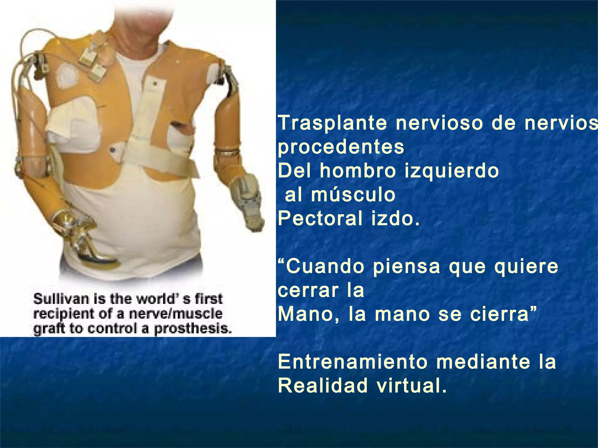 Trasplante nervioso de nervios
procedentes
Del hombro izquierdo
al músculo
Pectoral izdo.
“Cuando piensa que quiere
cerrar la
Mano, la mano se cierra”
Entrenamiento mediante la
Realidad virtual.

 