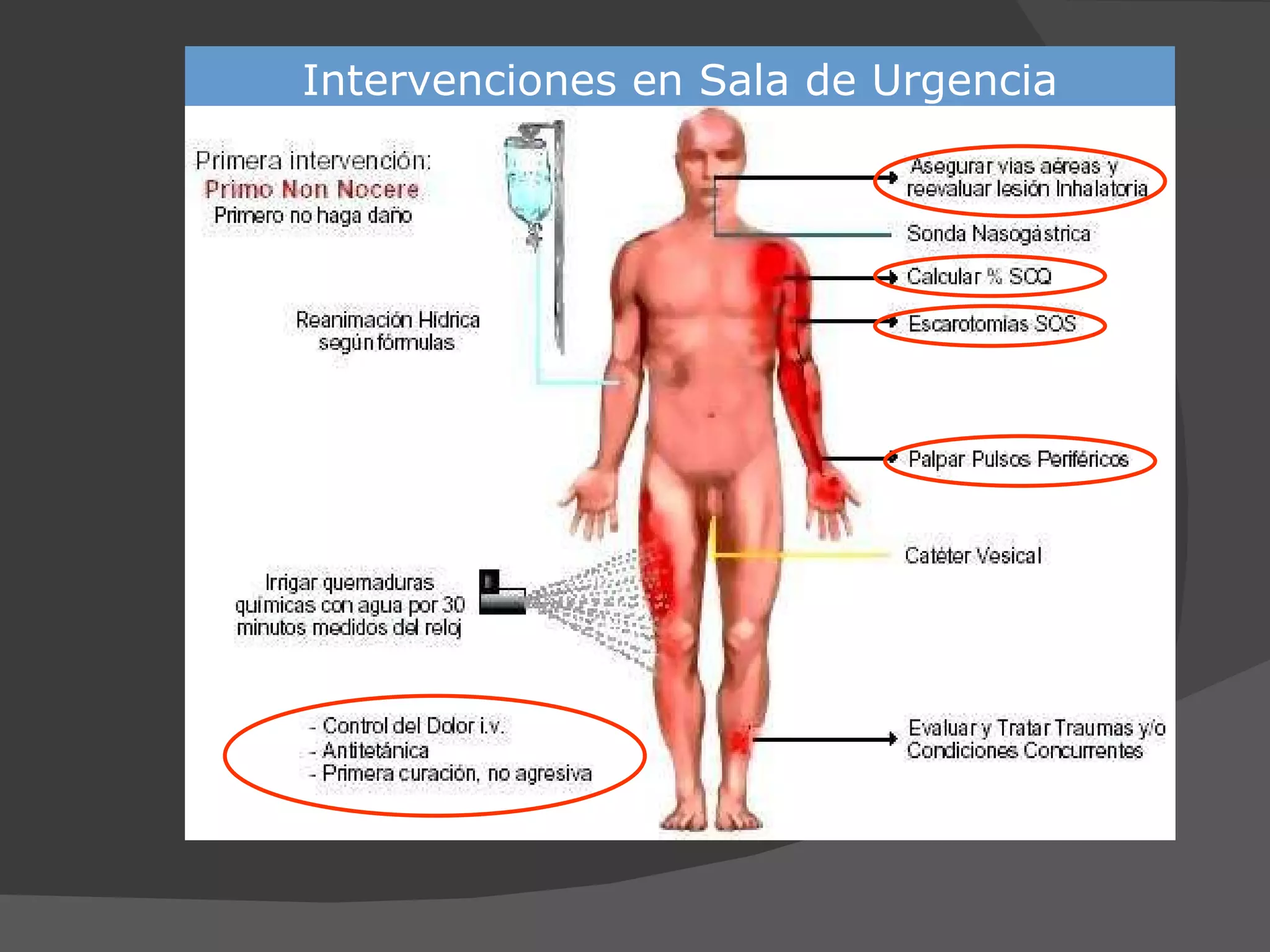 Intervenciones en Sala de Urgencia 
