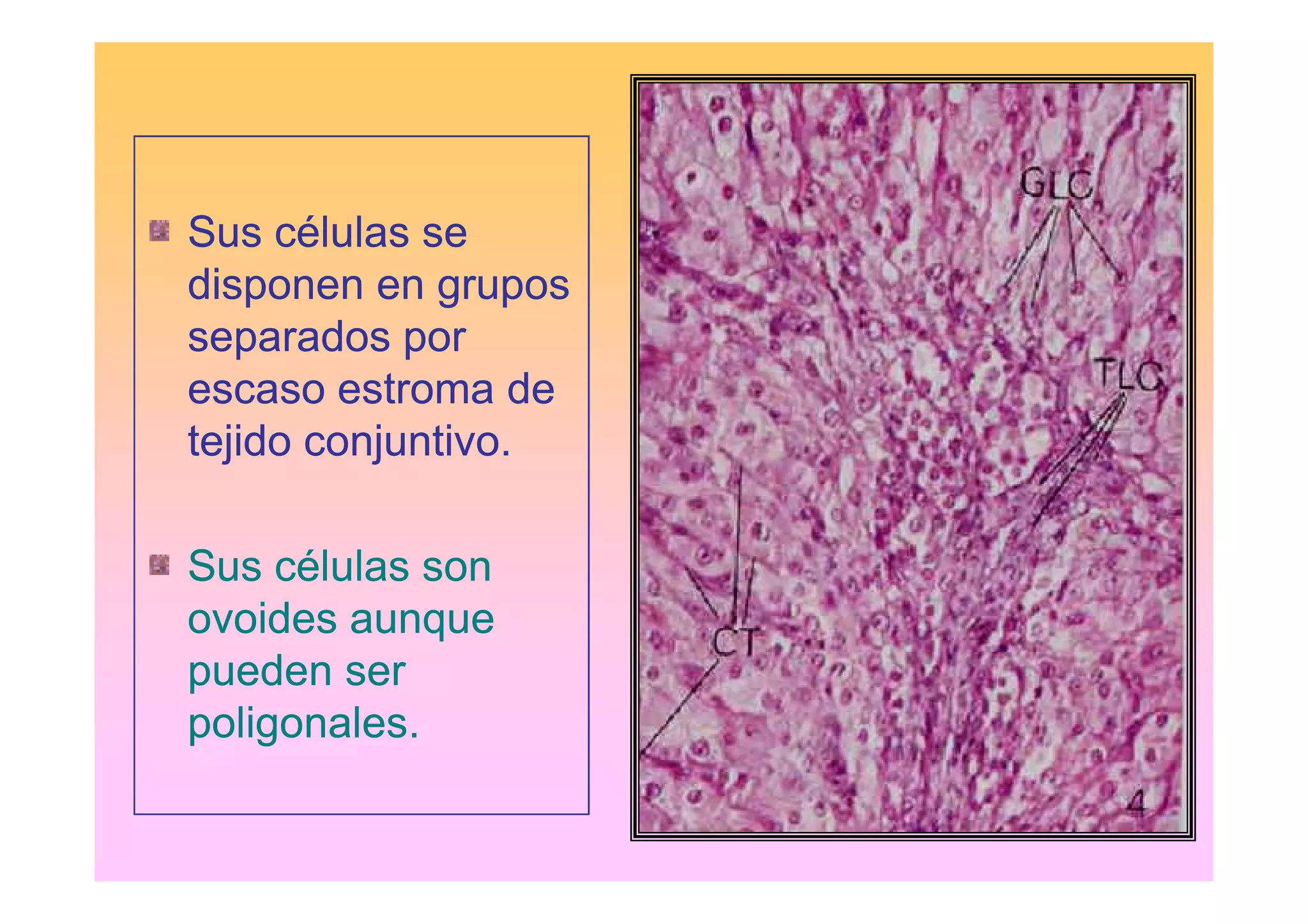 Sus células se
disponen en grupos
separados por
escaso estroma de
tejido conjuntivo.

Sus células son
ovoides aunque
pueden ser
poligonales.
 