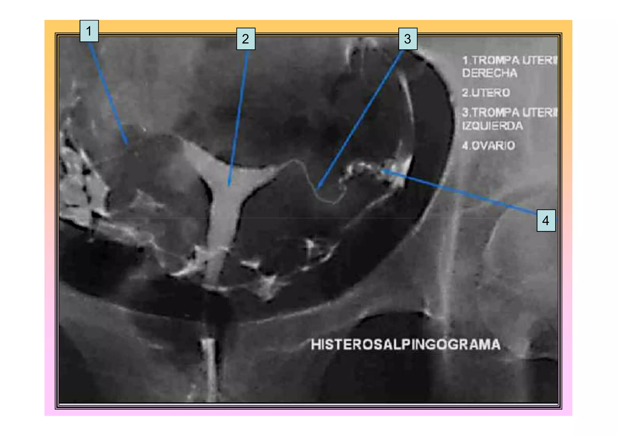 1
    2   3




            4
 