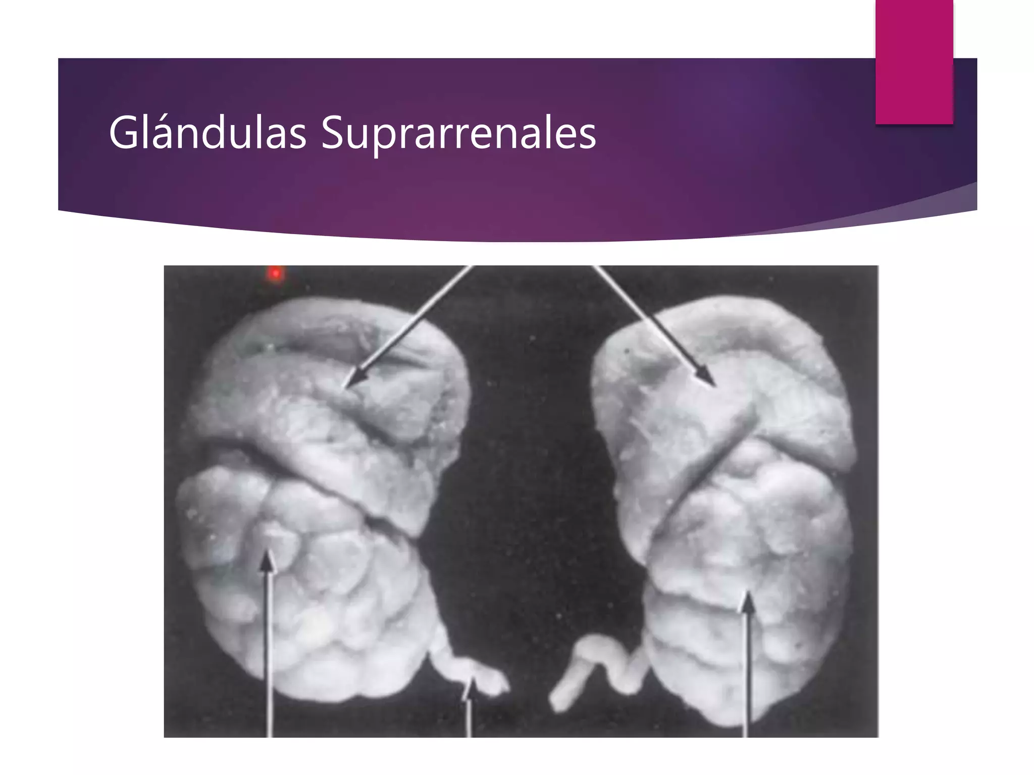 Glándulas Suprarrenales
 