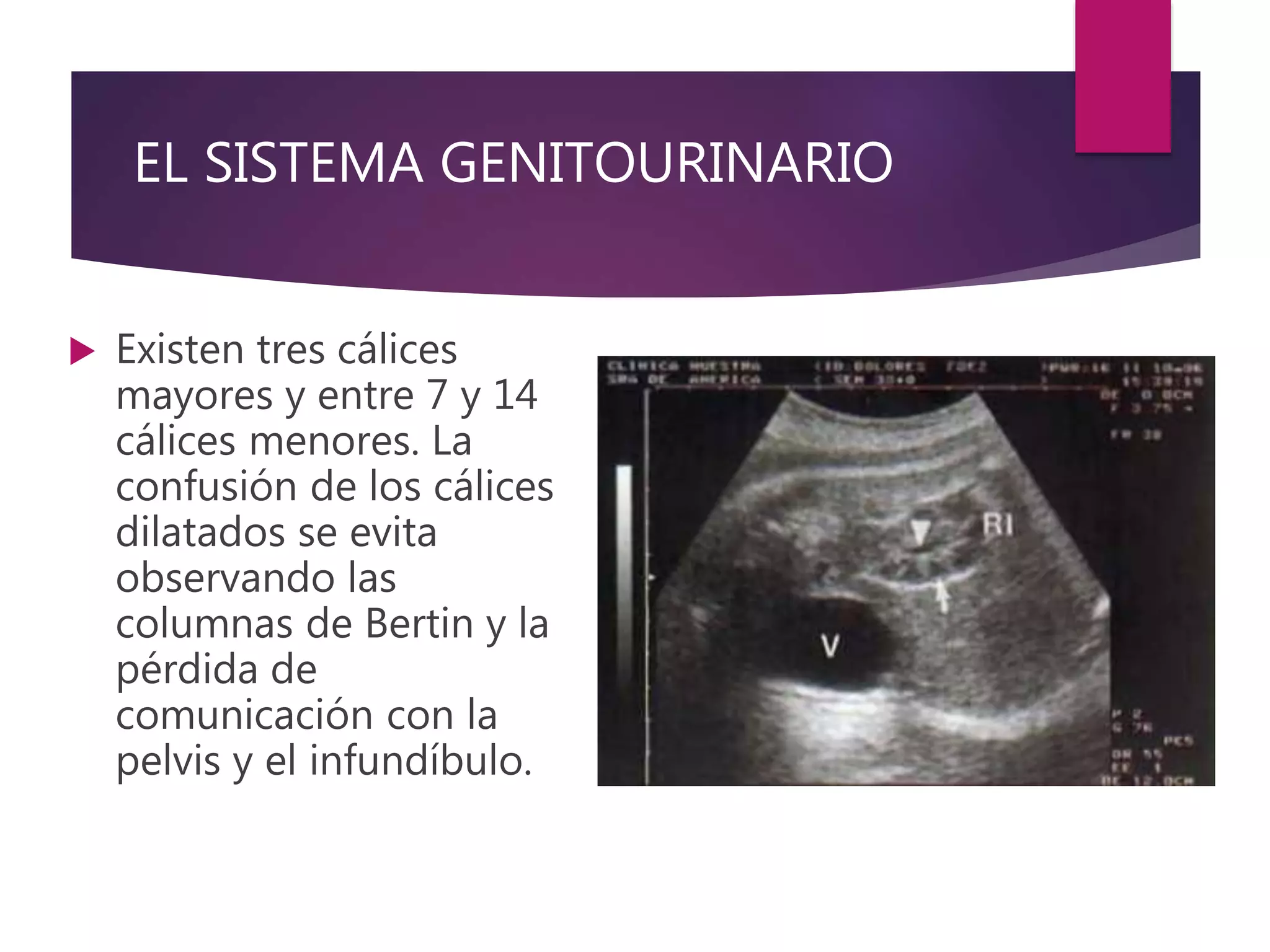 EL SISTEMA GENITOURINARIO
 Existen tres cálices
mayores y entre 7 y 14
cálices menores. La
confusión de los cálices
dilatados se evita
observando las
columnas de Bertin y la
pérdida de
comunicación con la
pelvis y el infundíbulo.
 