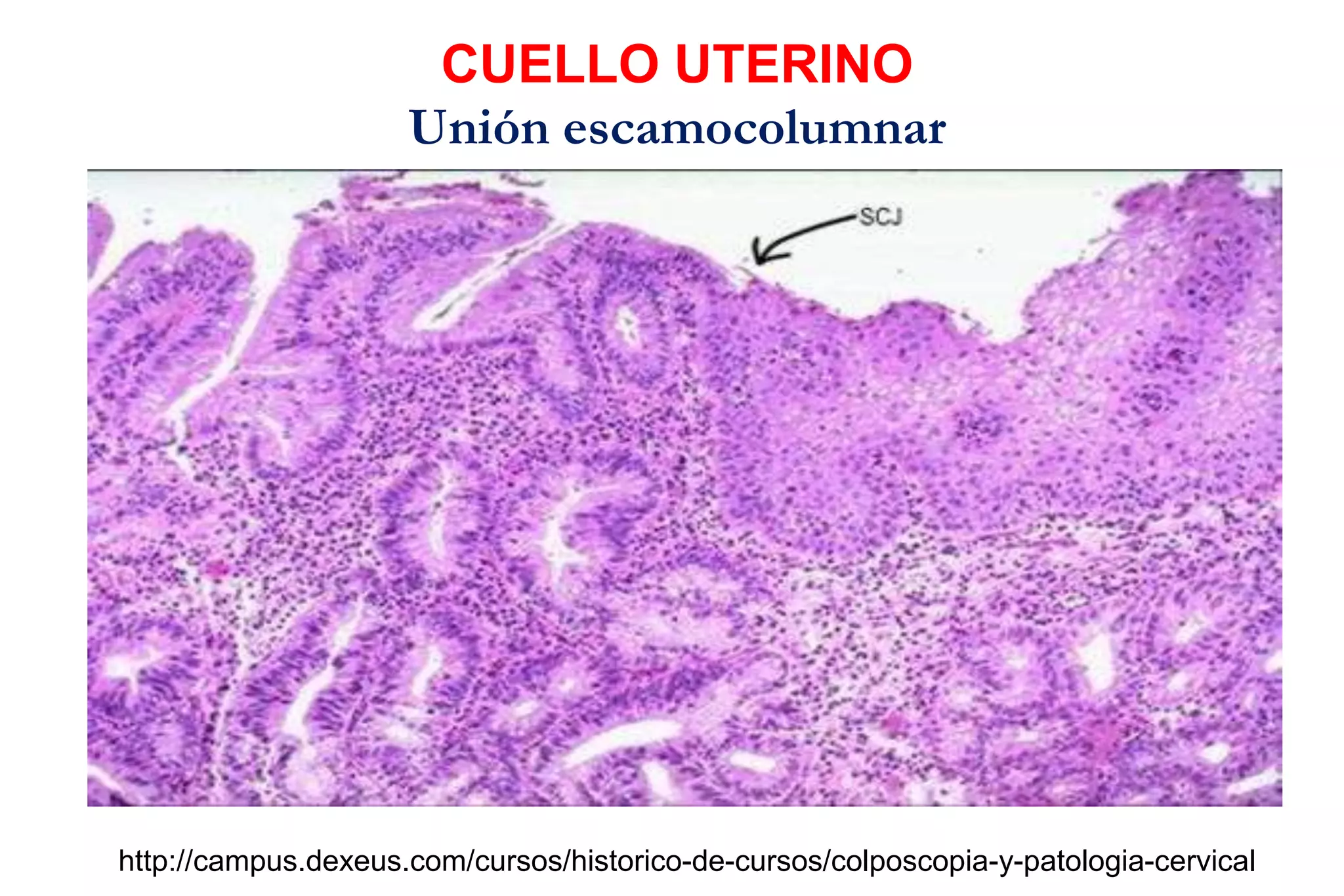 CUELLO UTERINO
Unión escamocolumnar
http://campus.dexeus.com/cursos/historico-de-cursos/colposcopia-y-patologia-cervical
 