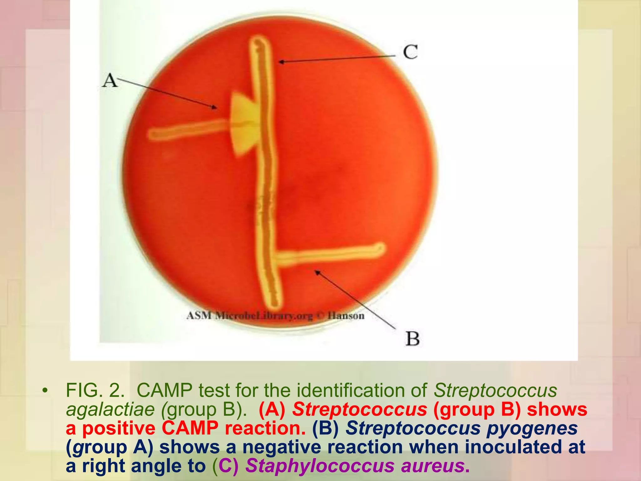 • FIG. 2. CAMP test for the identification of Streptococcus
agalactiae (group B). (A) Streptococcus (group B) shows
a positive CAMP reaction. (B) Streptococcus pyogenes
(group A) shows a negative reaction when inoculated at
a right angle to (C) Staphylococcus aureus.
 