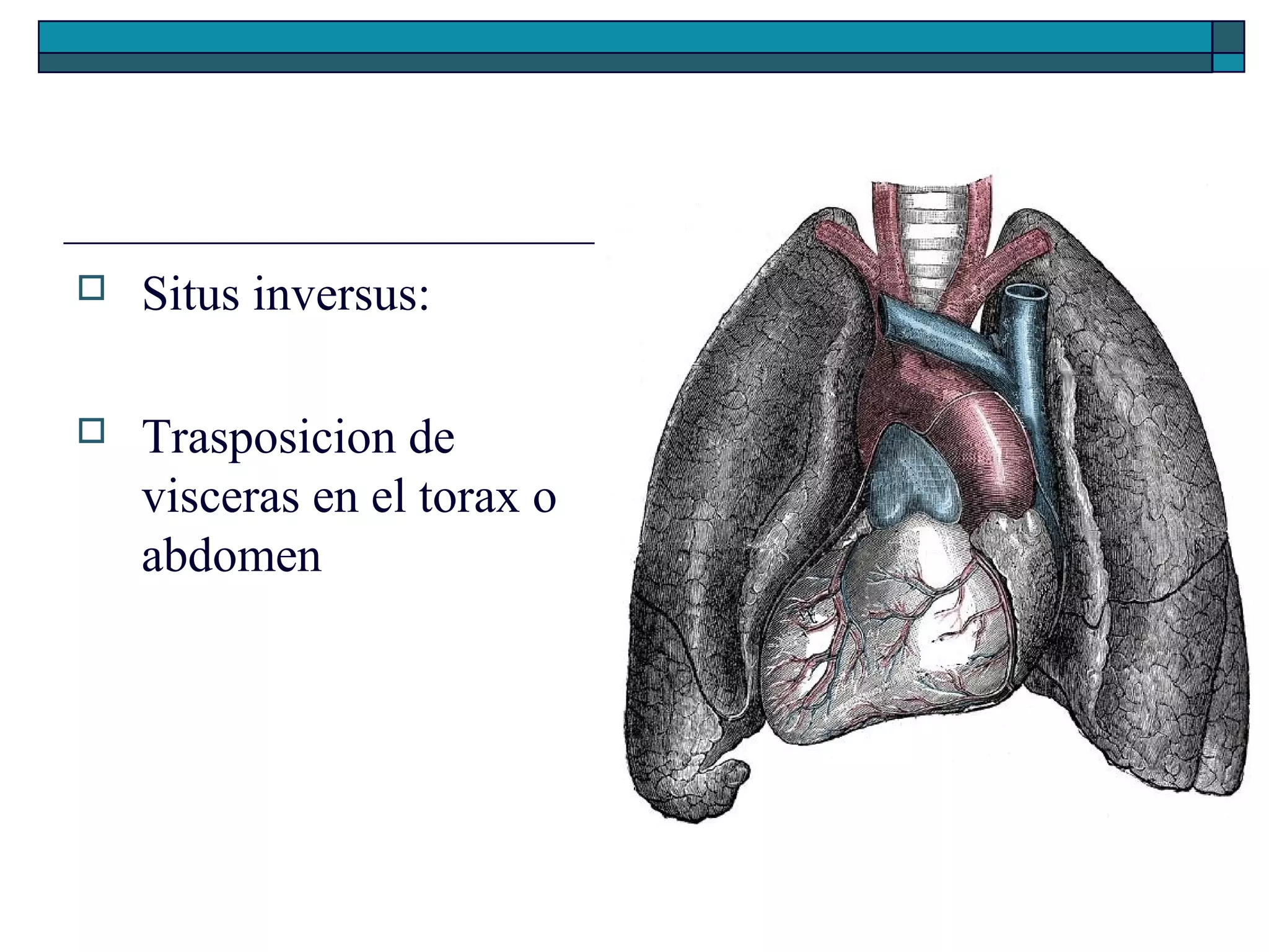 

Situs inversus:



Trasposicion de
visceras en el torax o
abdomen

 