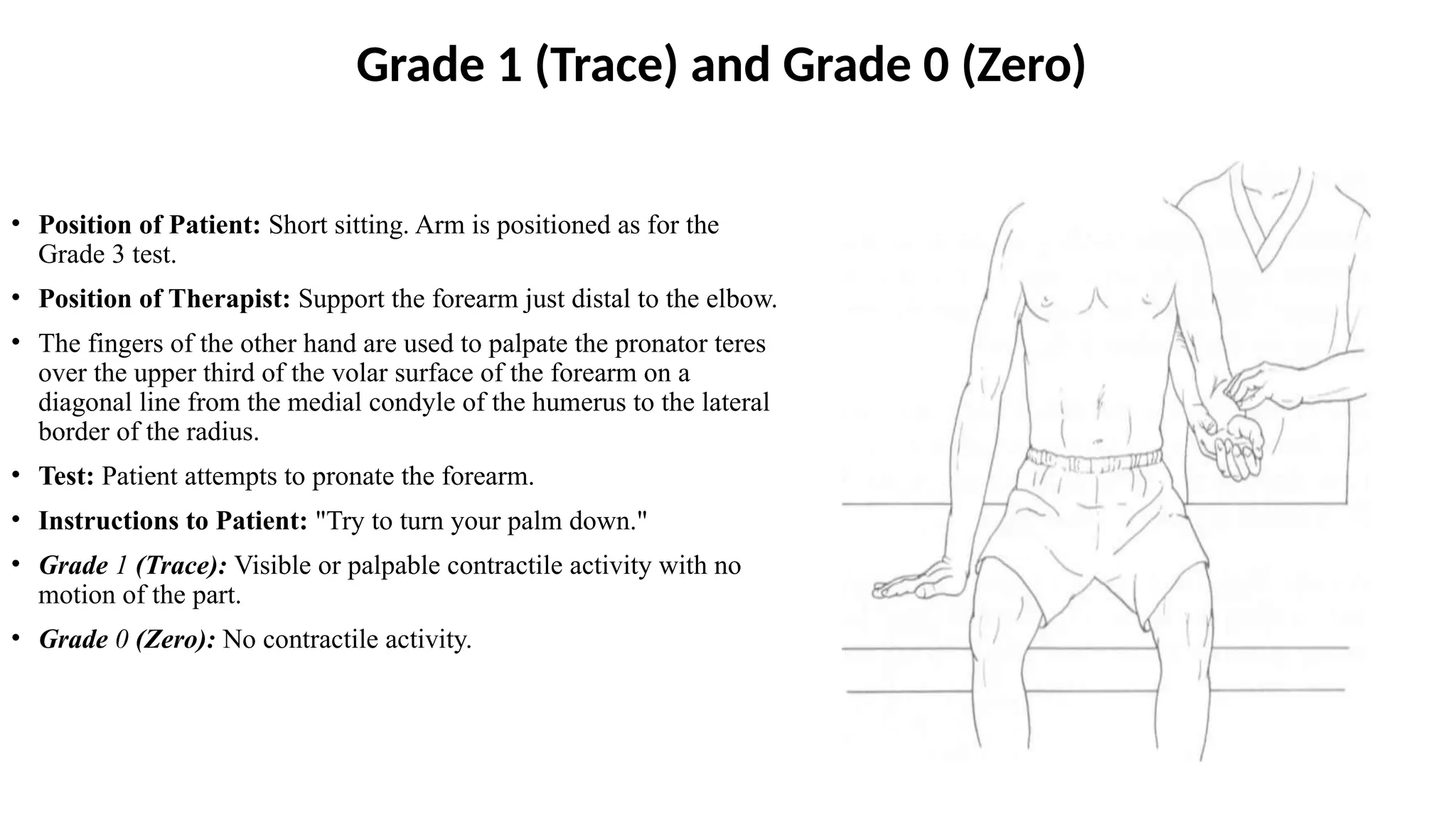 Grade 1 (Trace) and Grade 0 (Zero)
• Position of Patient: Short sitting. Arm is positioned as for the
Grade 3 test.
• Position of Therapist: Support the forearm just distal to the elbow.
• The fingers of the other hand are used to palpate the pronator teres
over the upper third of the volar surface of the forearm on a
diagonal line from the medial condyle of the humerus to the lateral
border of the radius.
• Test: Patient attempts to pronate the forearm.
• Instructions to Patient: "Try to turn your palm down."
• Grade 1 (Trace): Visible or palpable contractile activity with no
motion of the part.
• Grade 0 (Zero): No contractile activity.
 