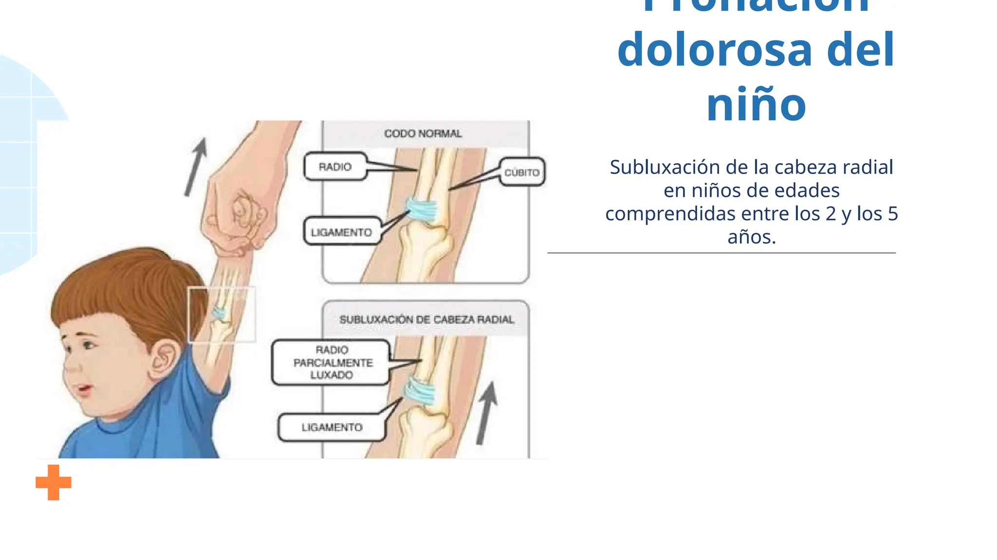 Pronación
dolorosa del
niño
Subluxación de la cabeza radial
en niños de edades
comprendidas entre los 2 y los 5
años.
 