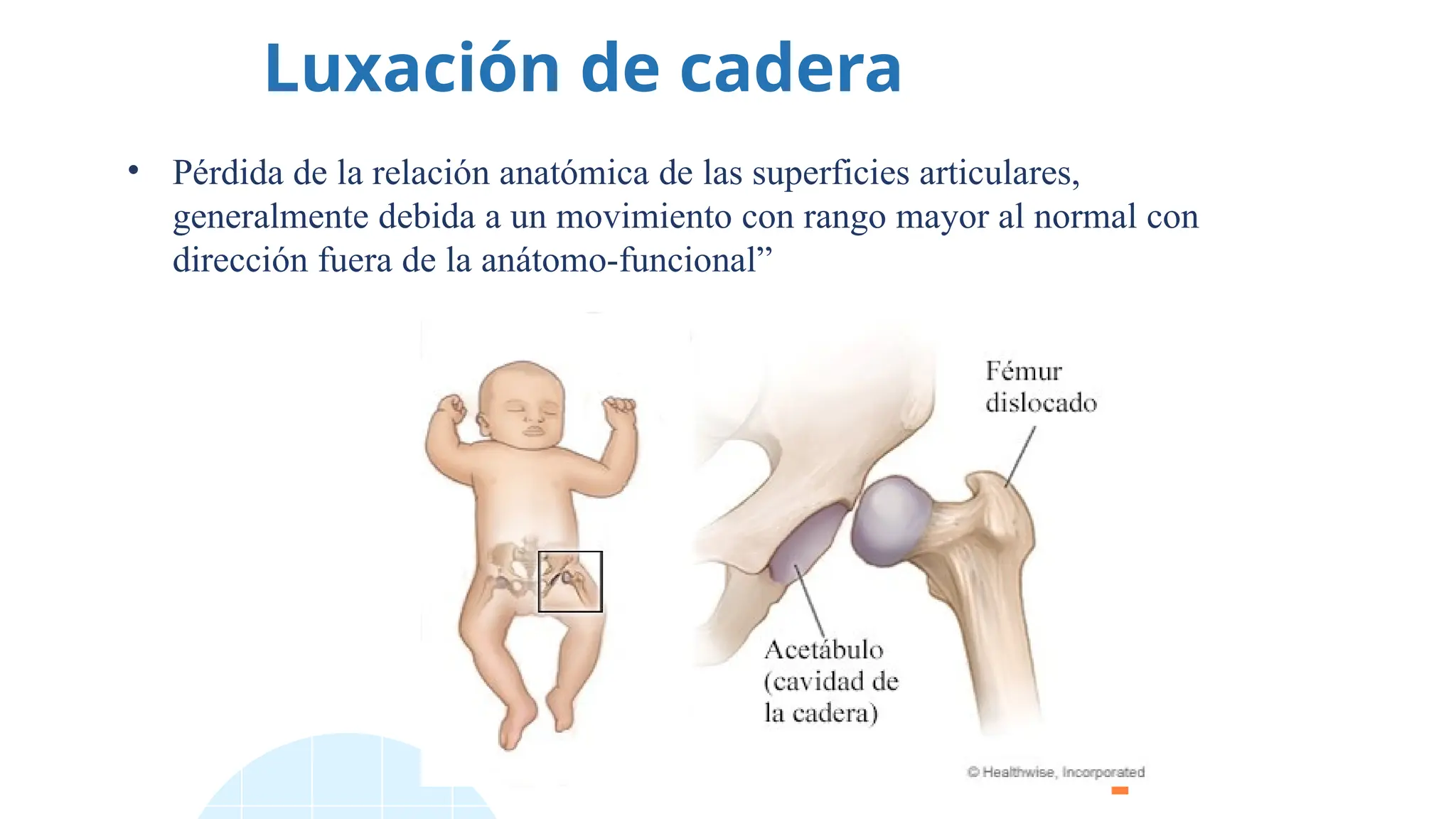 Luxación de cadera
• Pérdida de la relación anatómica de las superficies articulares,
generalmente debida a un movimiento con rango mayor al normal con
dirección fuera de la anátomo-funcional”
 