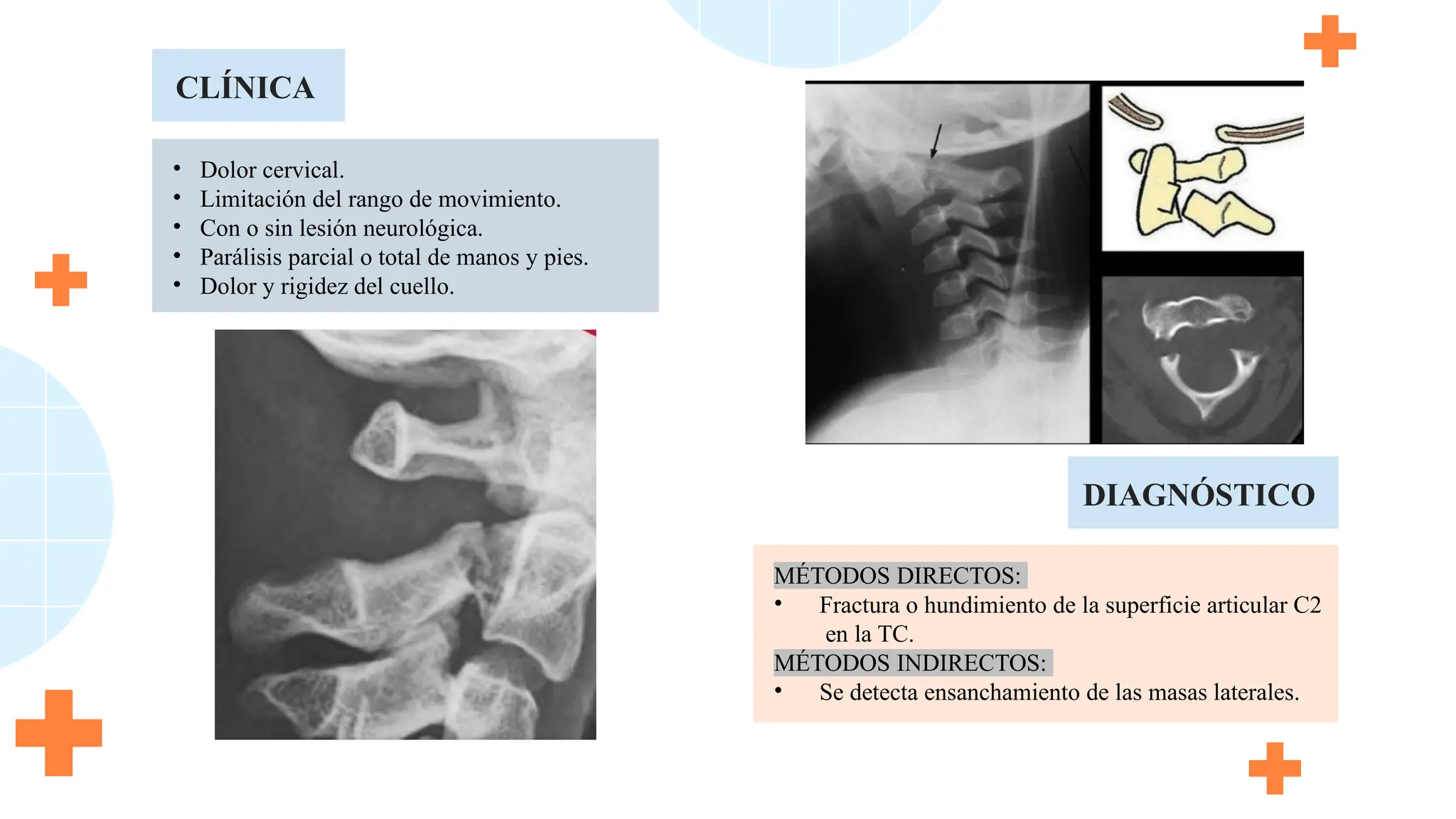 • Dolor cervical.
• Limitación del rango de movimiento.
• Con o sin lesión neurológica.
• Parálisis parcial o total de manos y pies.
• Dolor y rigidez del cuello.
CLÍNICA
MÉTODOS DIRECTOS:
• Fractura o hundimiento de la superficie articular C2
en la TC.
MÉTODOS INDIRECTOS:
• Se detecta ensanchamiento de las masas laterales.
DIAGNÓSTICO
 